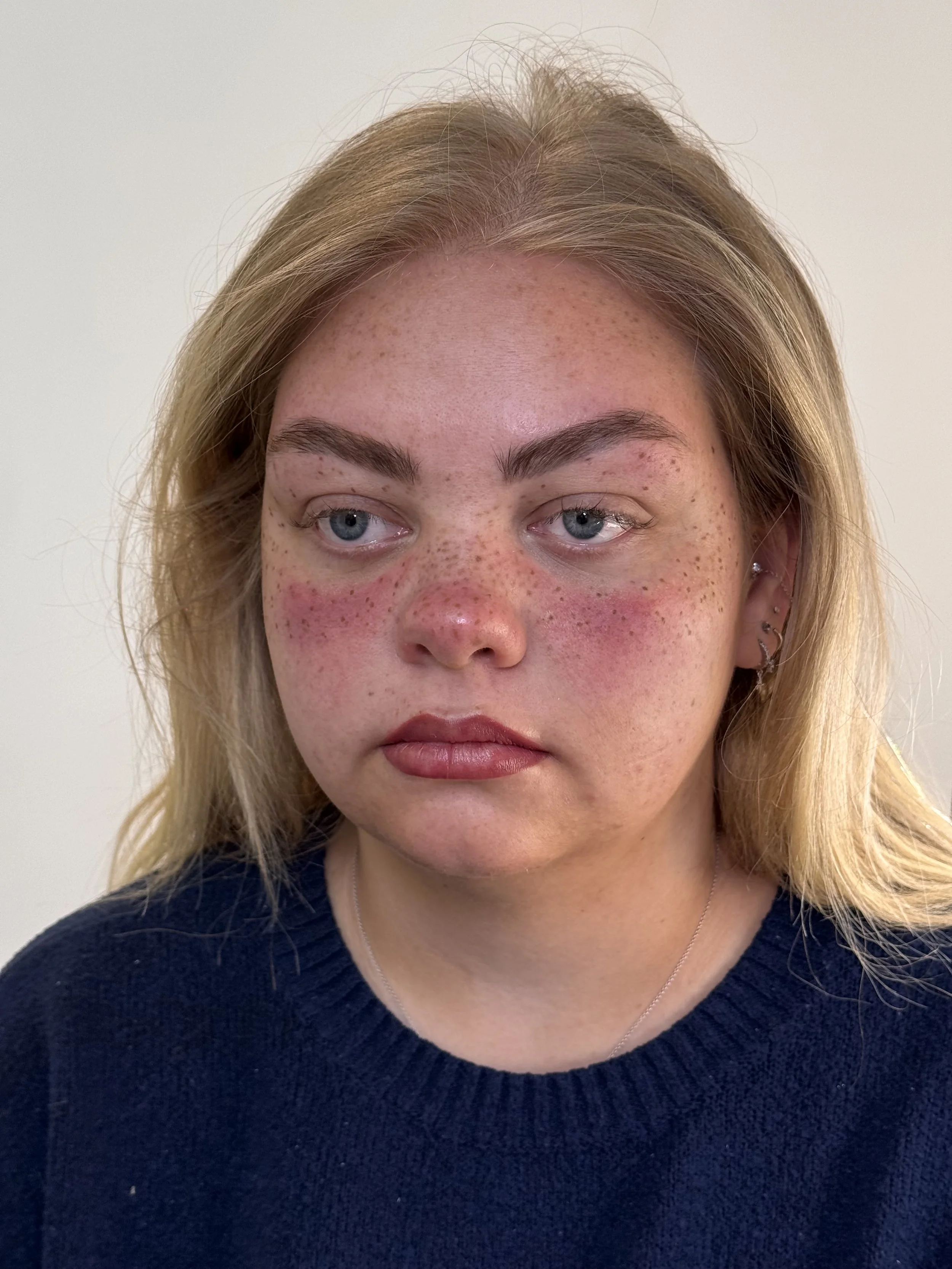A young woman with blonde hair, fair skin, and freckles, wearing a dark sweater, looking slightly to the side with a neutral expression.
