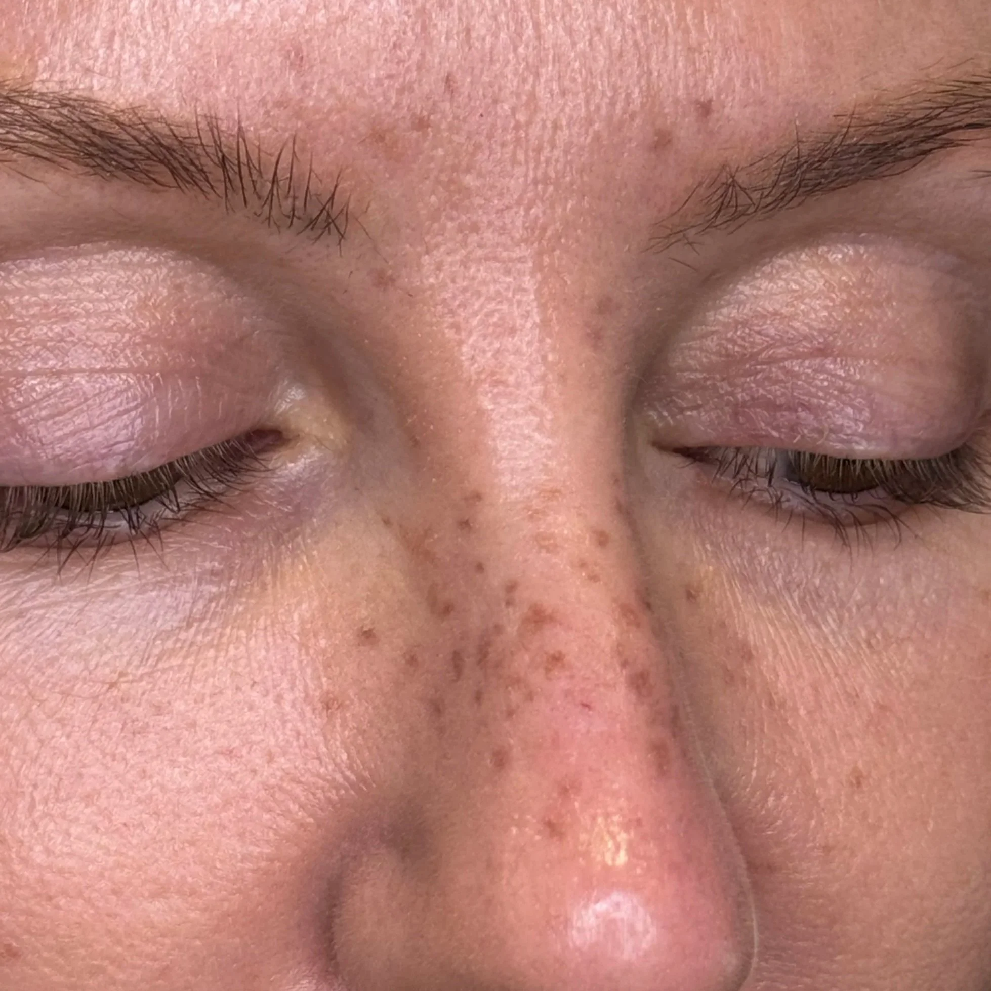 Healed faux freckles freckle tattoo pmu uk Leeds Manchester permanent make-up