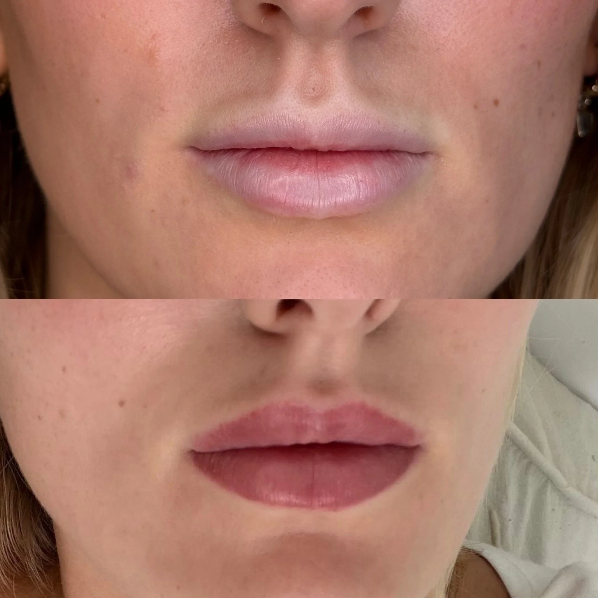 Close-up of a woman's face showing before and after PMU lip blush Leeds