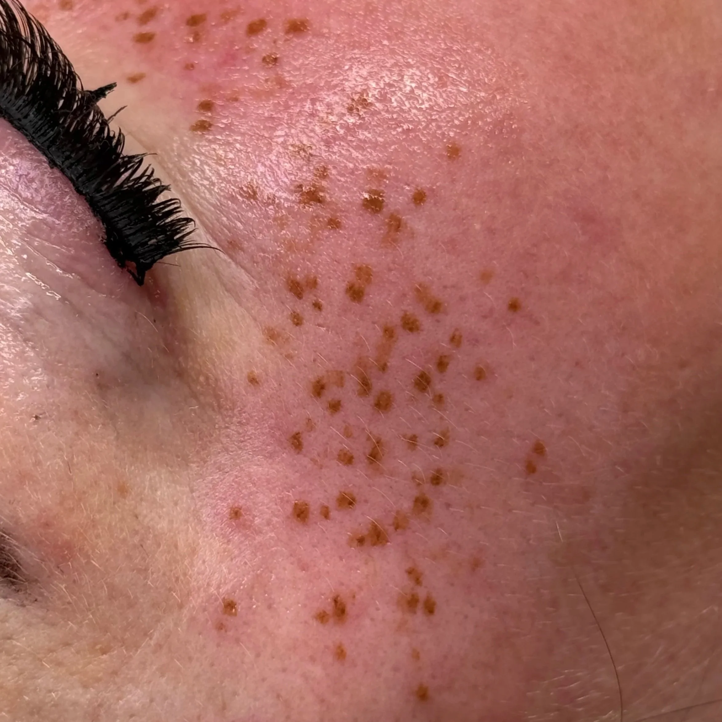 faux freckle tattoo close up permanent make-up pmu leeds yorkshire uk england