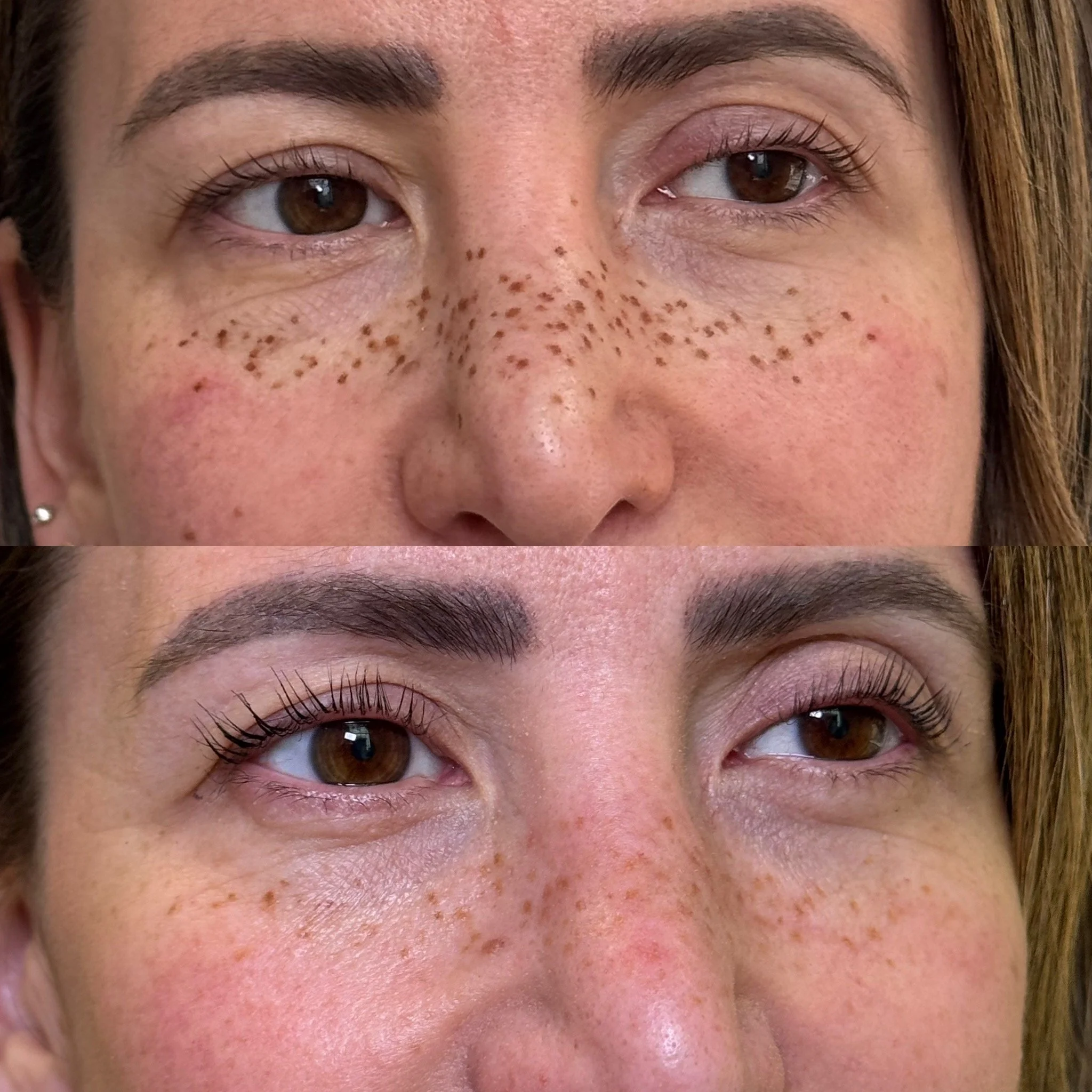 Before & after faux freckle tattoos