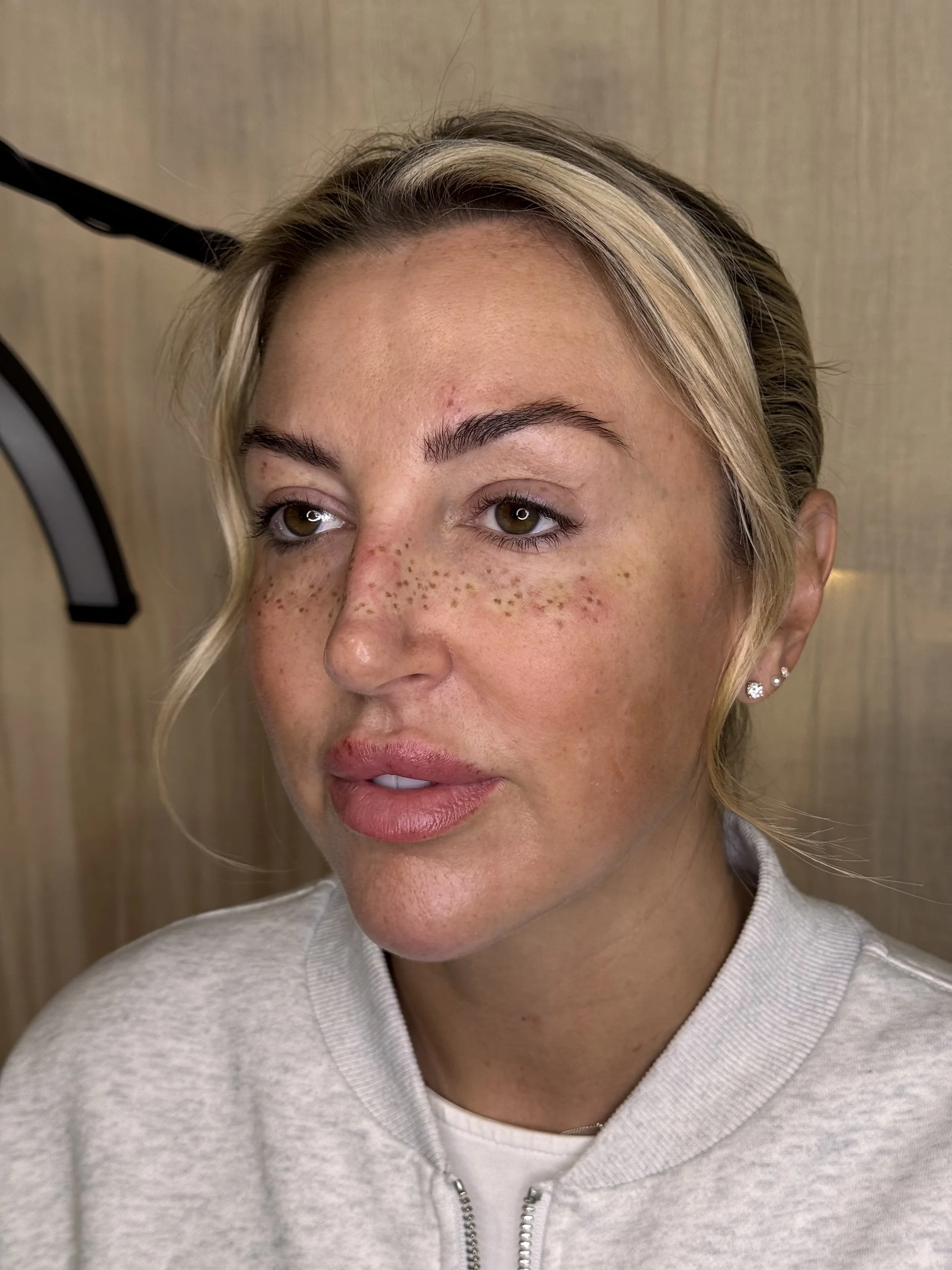 faux freckle tattoo permanent make-up pmu leeds yorkshire uk england