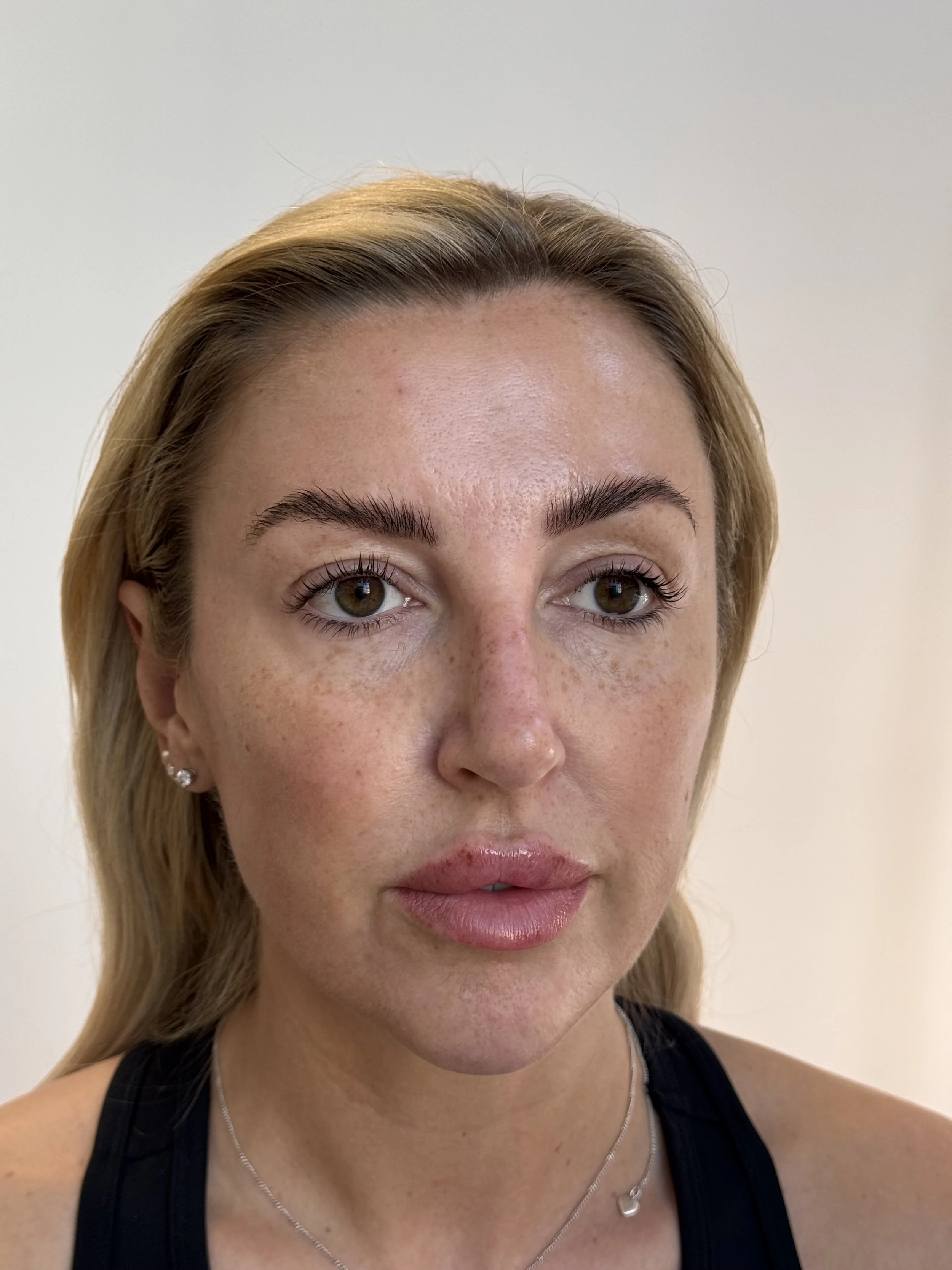 Healed faux freckles freckle tattoo pmu uk Leeds Manchester permanent make-up