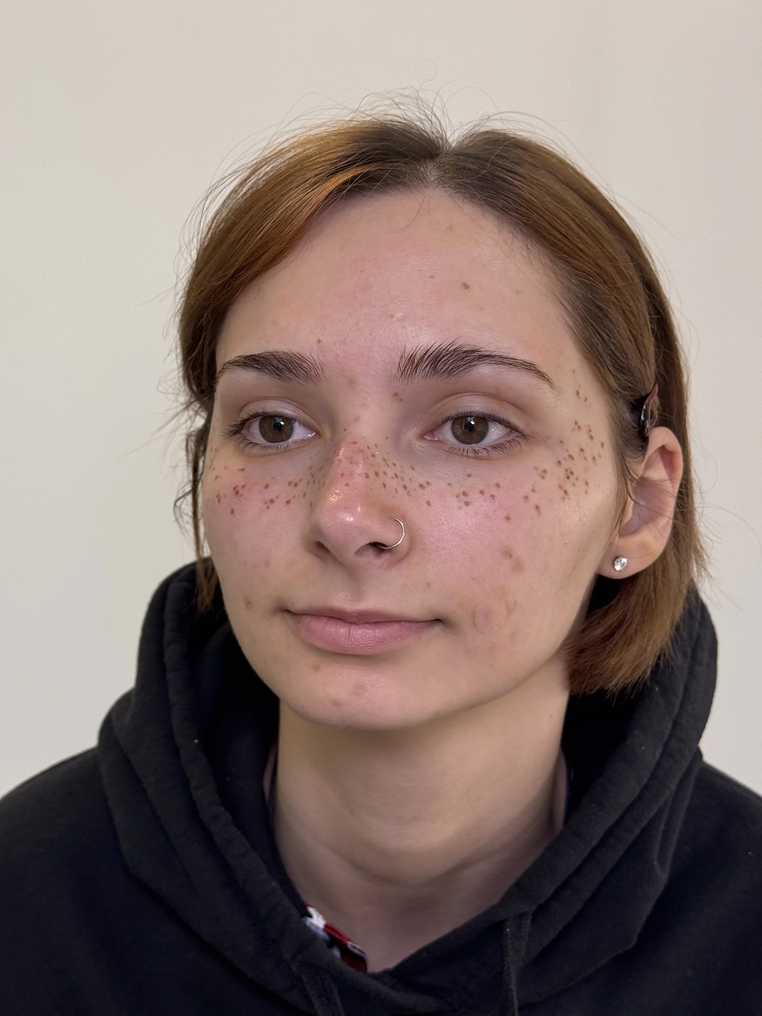 Medium coverage faux freckle tattoos
