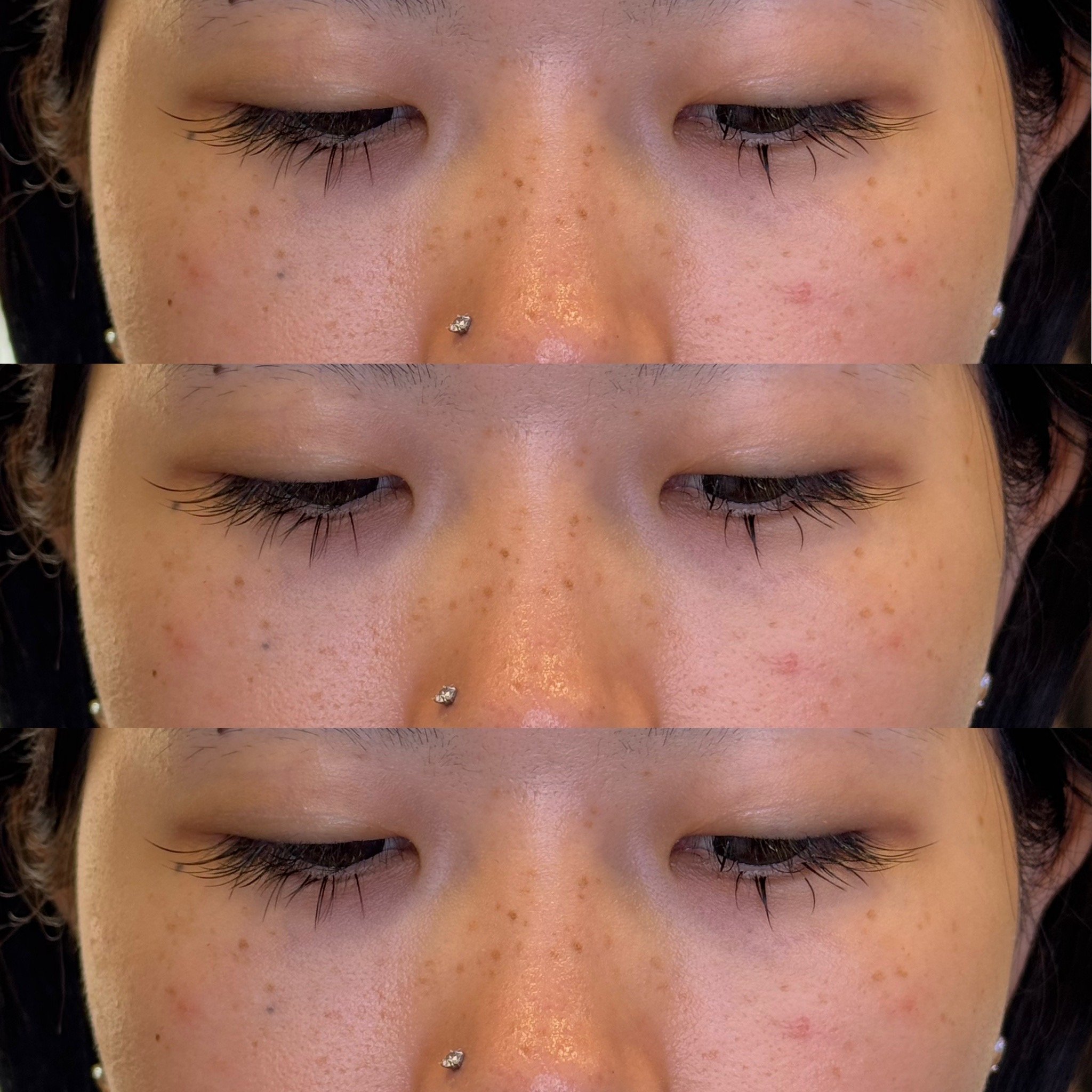 Healed faux freckles freckle tattoo pmu uk Leeds Manchester permanent make-up