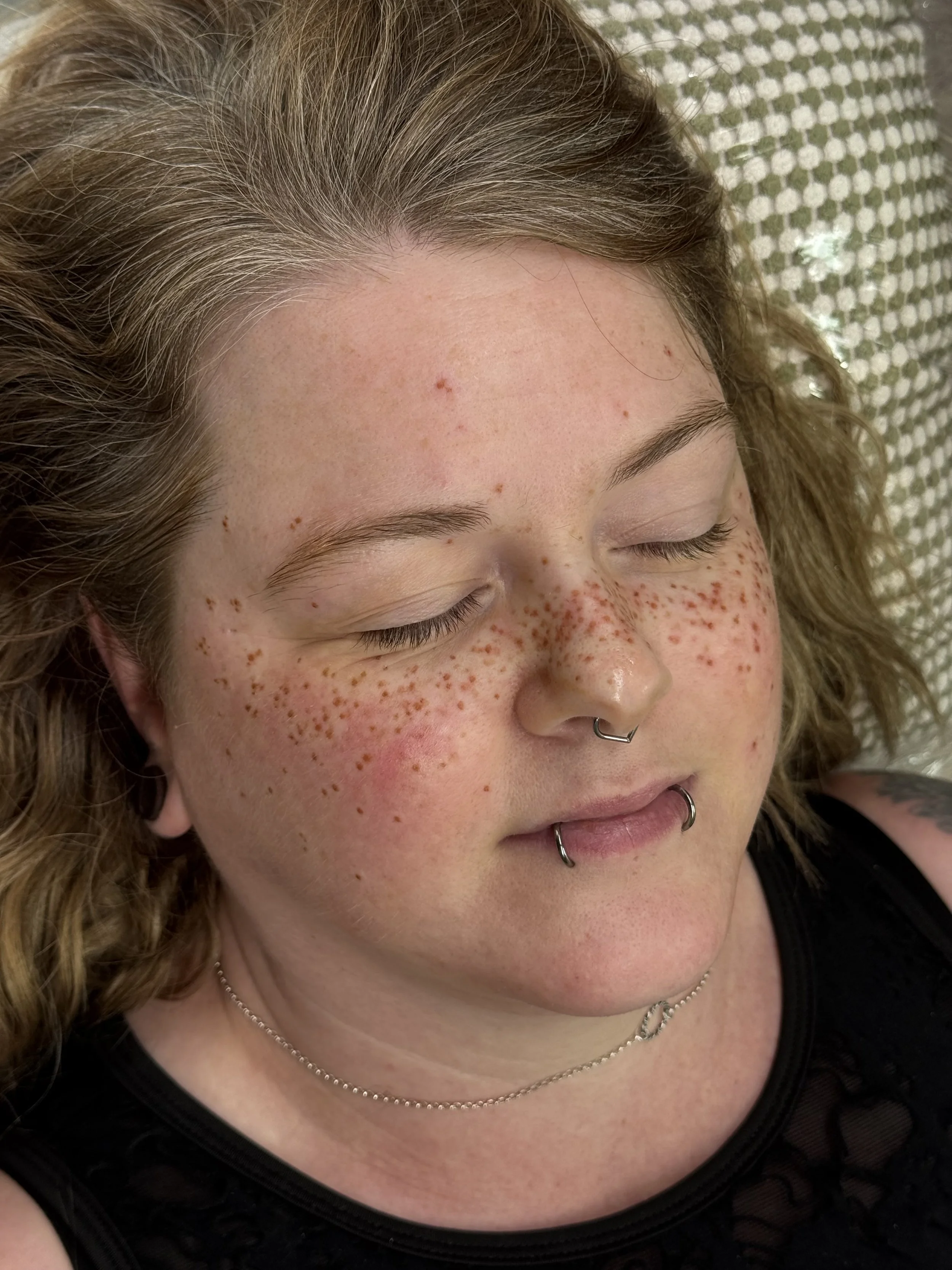 Heavy coverage freckle tattoos