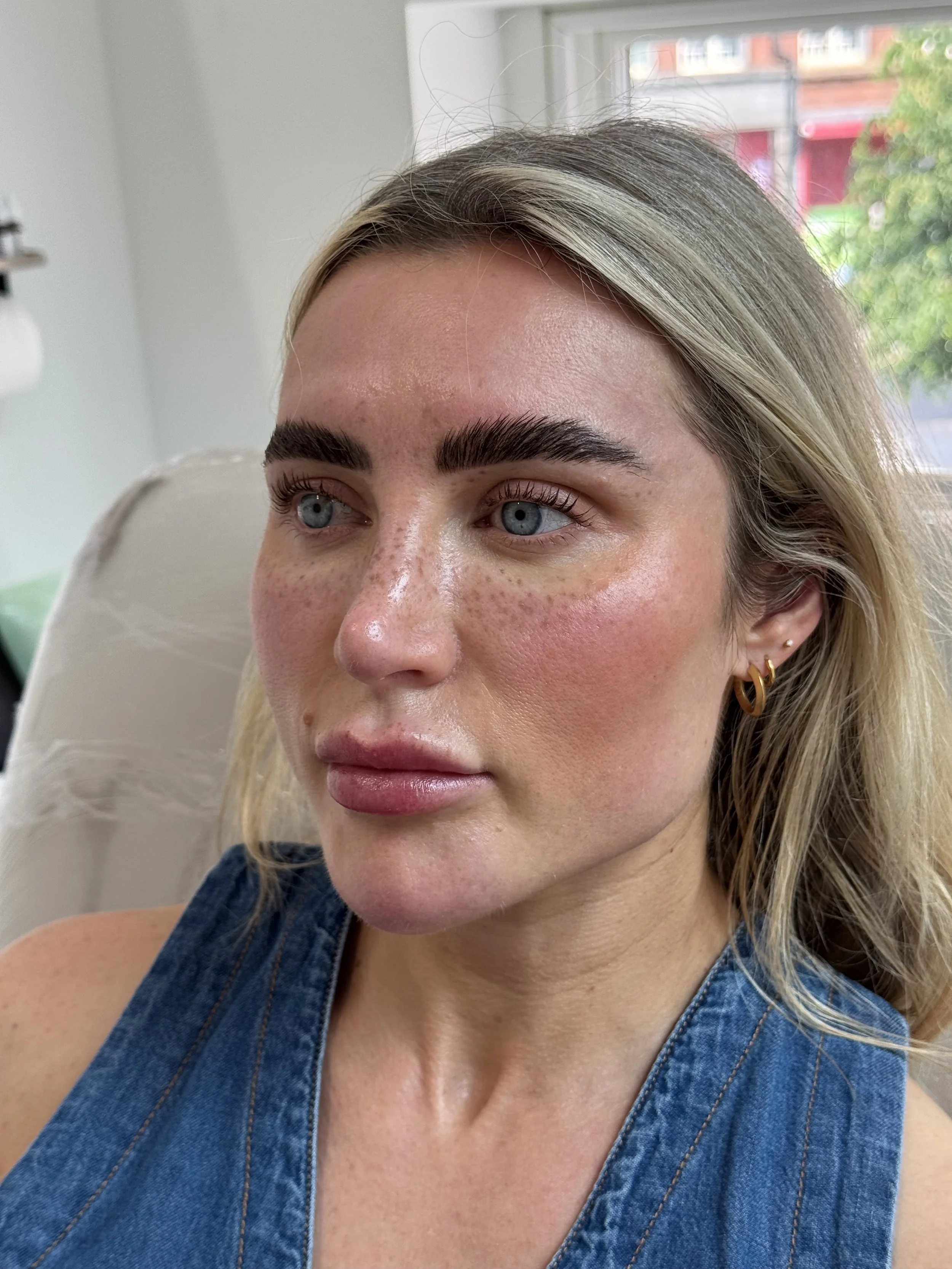 Healed faux freckles freckle tattoo pmu uk leeds manchester 