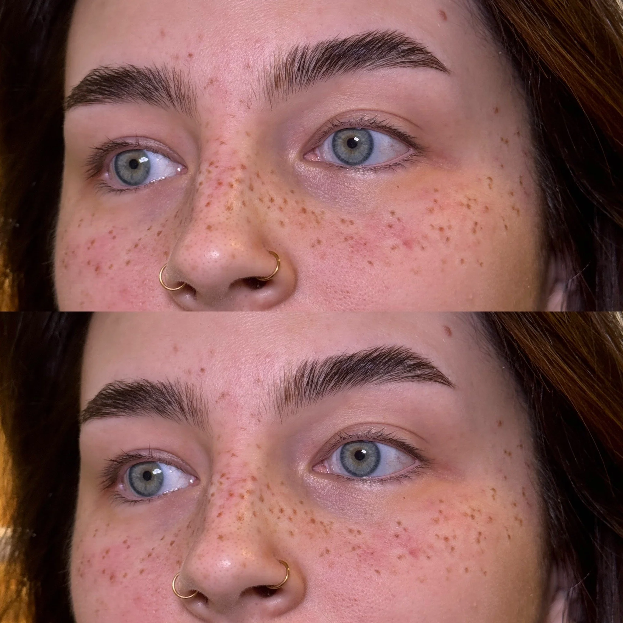 after picture of faux freckle tattoo treatment in leeds uk