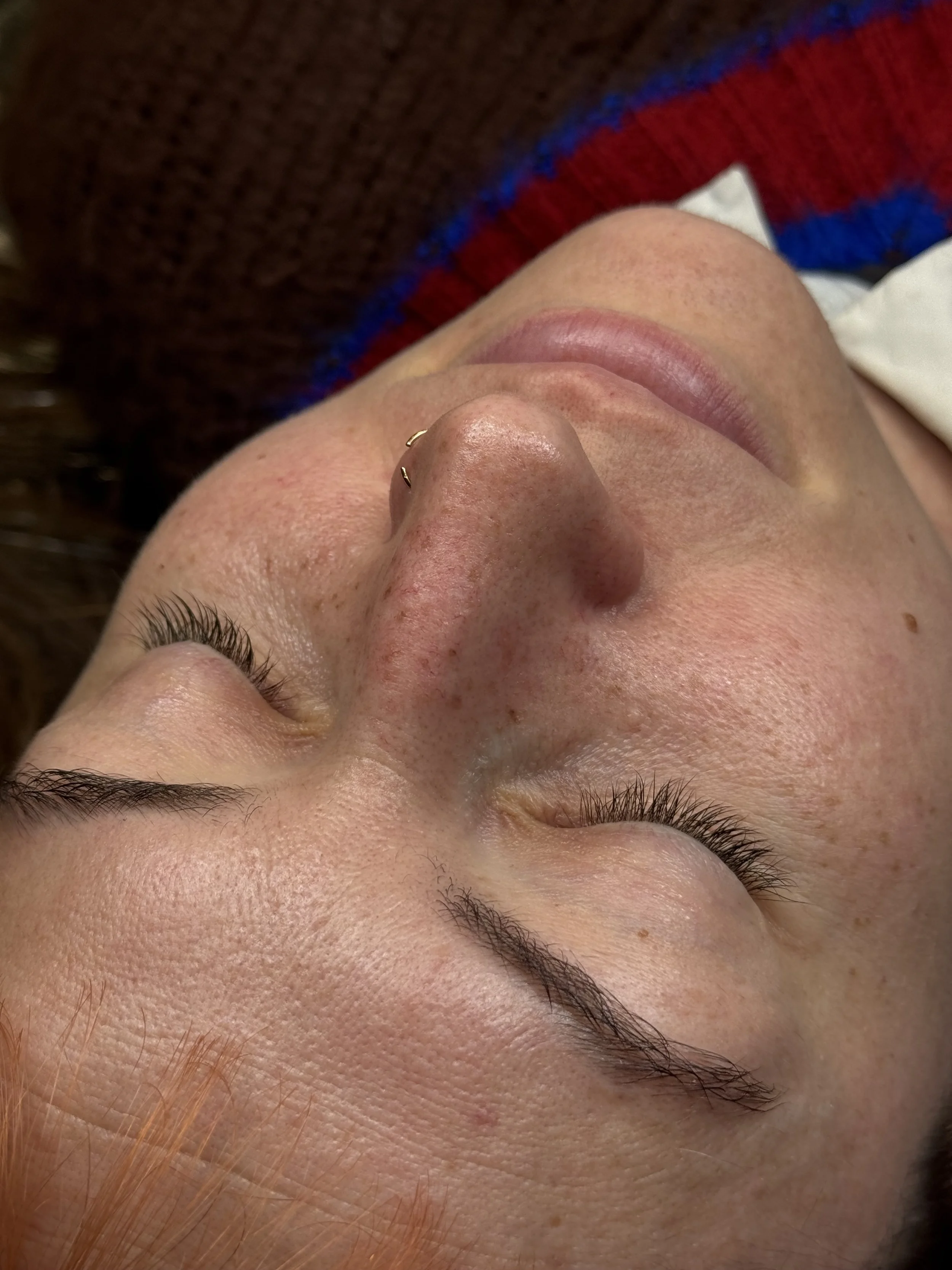 Healed faux freckles freckle tattoo pmu uk Leeds Manchester permanent make-up