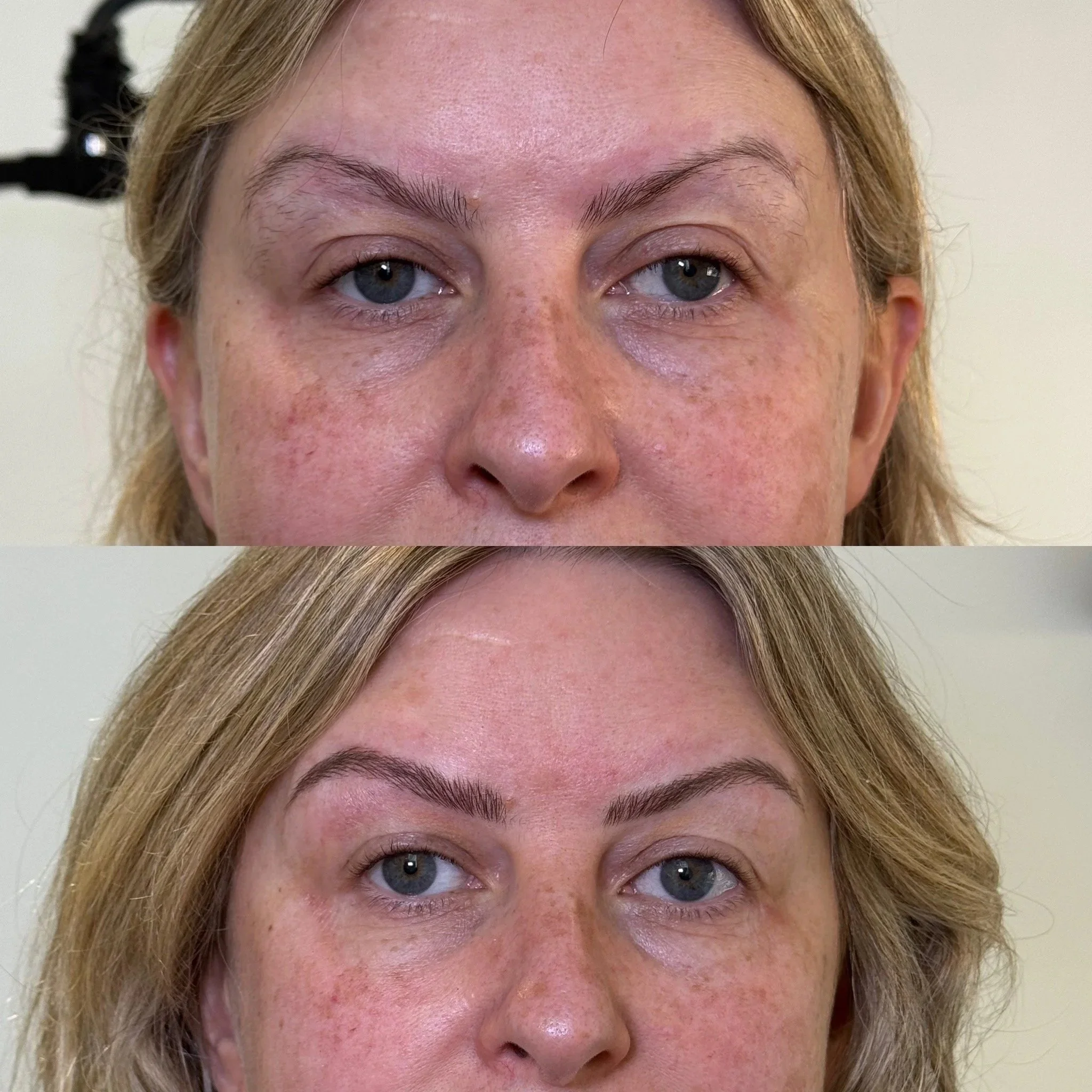 before and after brow transformation hyper-realism nano brows pmu