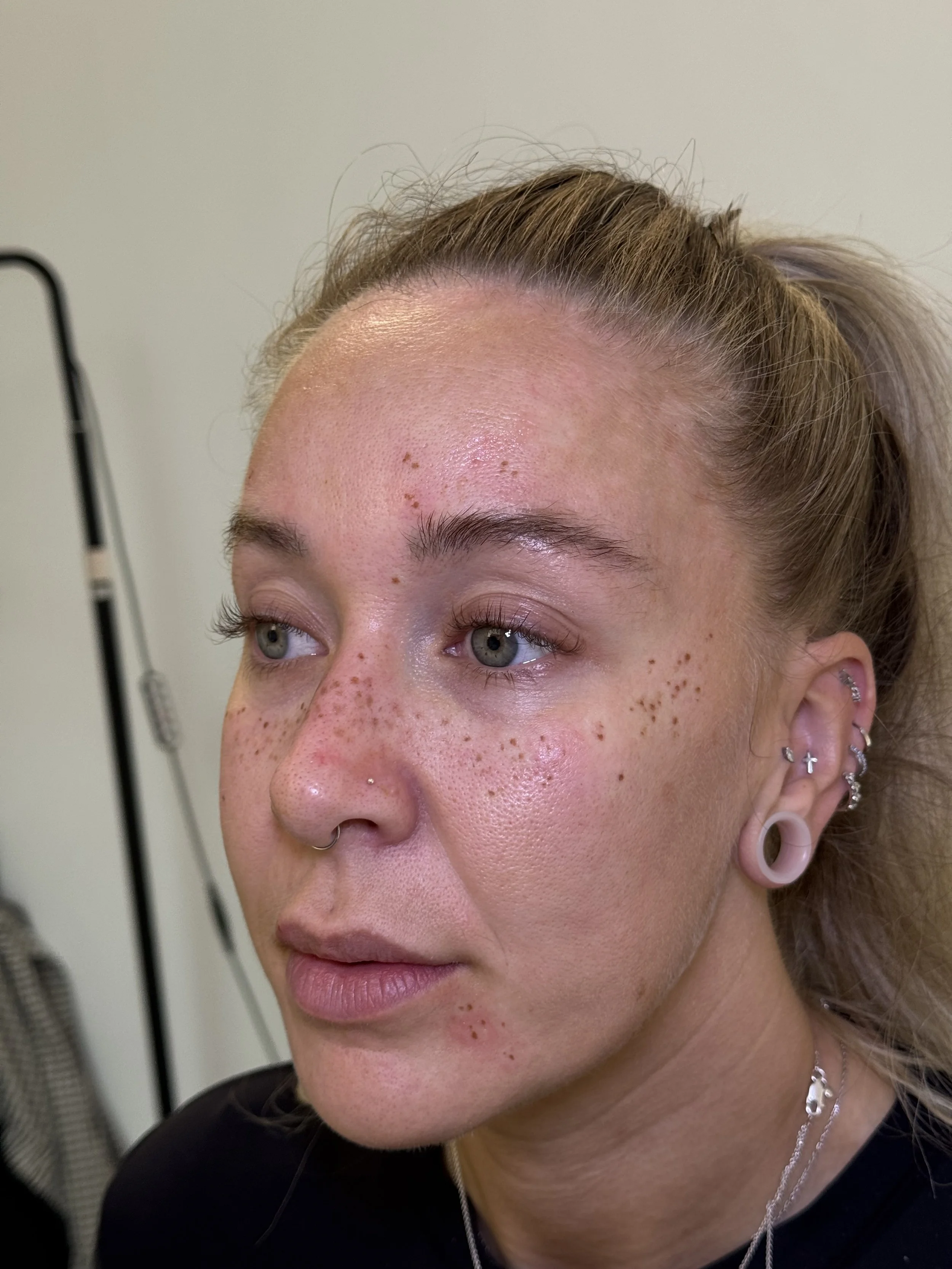 Light coverage freckle top up