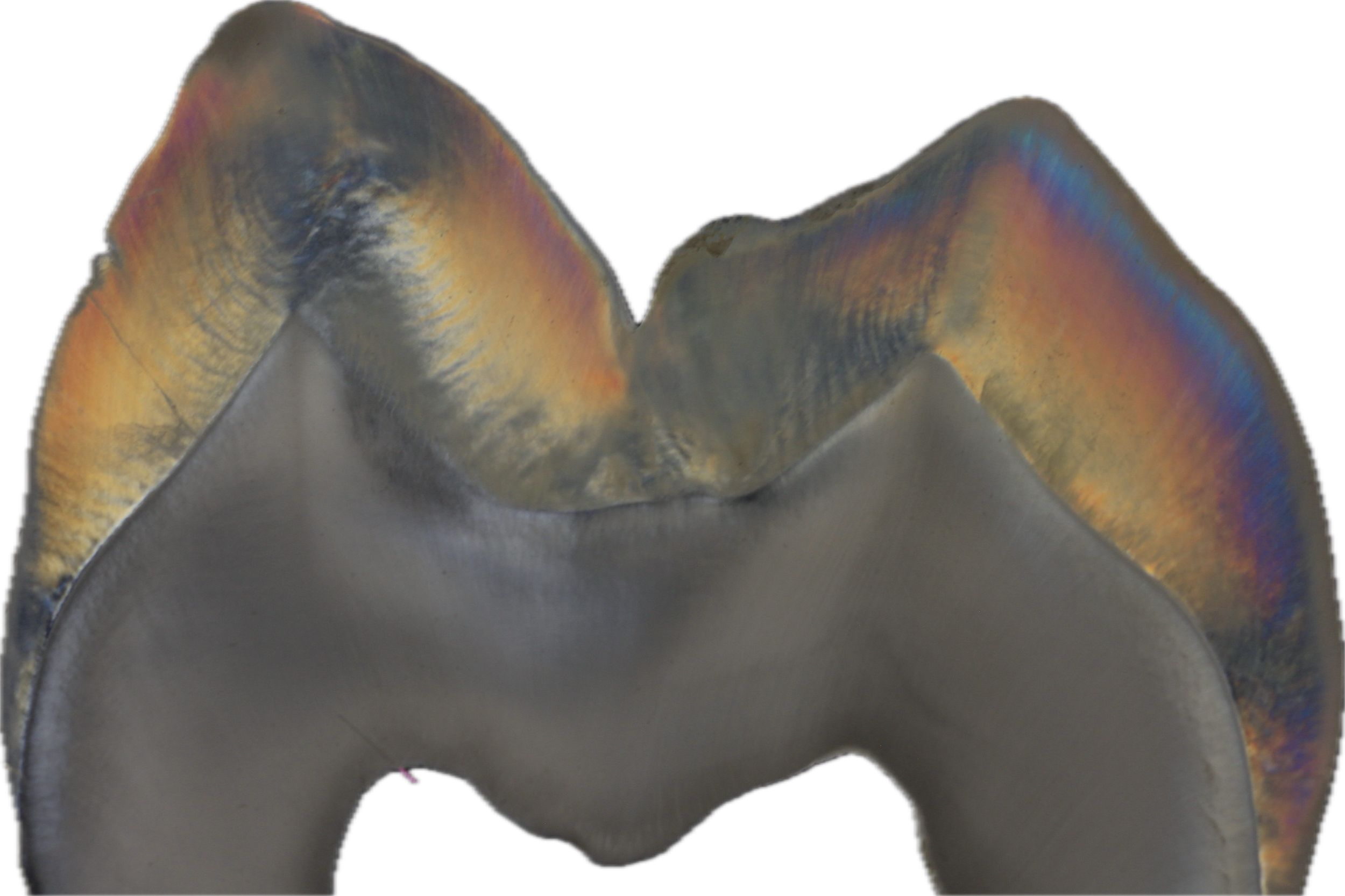 Close-up of dental teeth with visible gums and fillings.