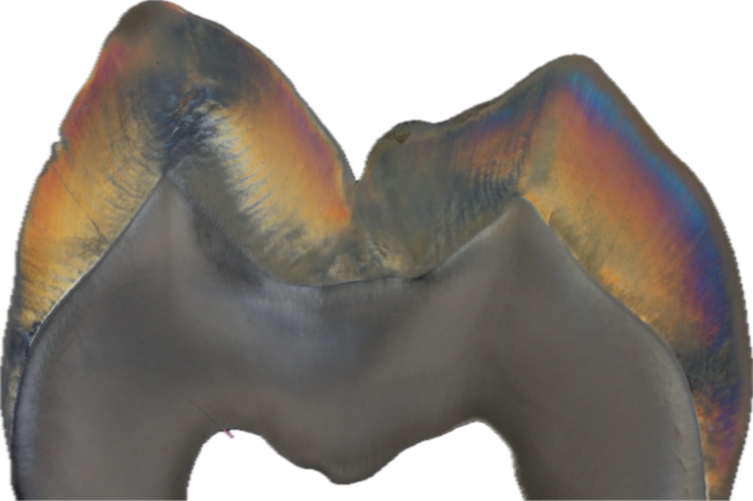 Close-up of teeth and pink gums, showing the inside of a person's mouth.