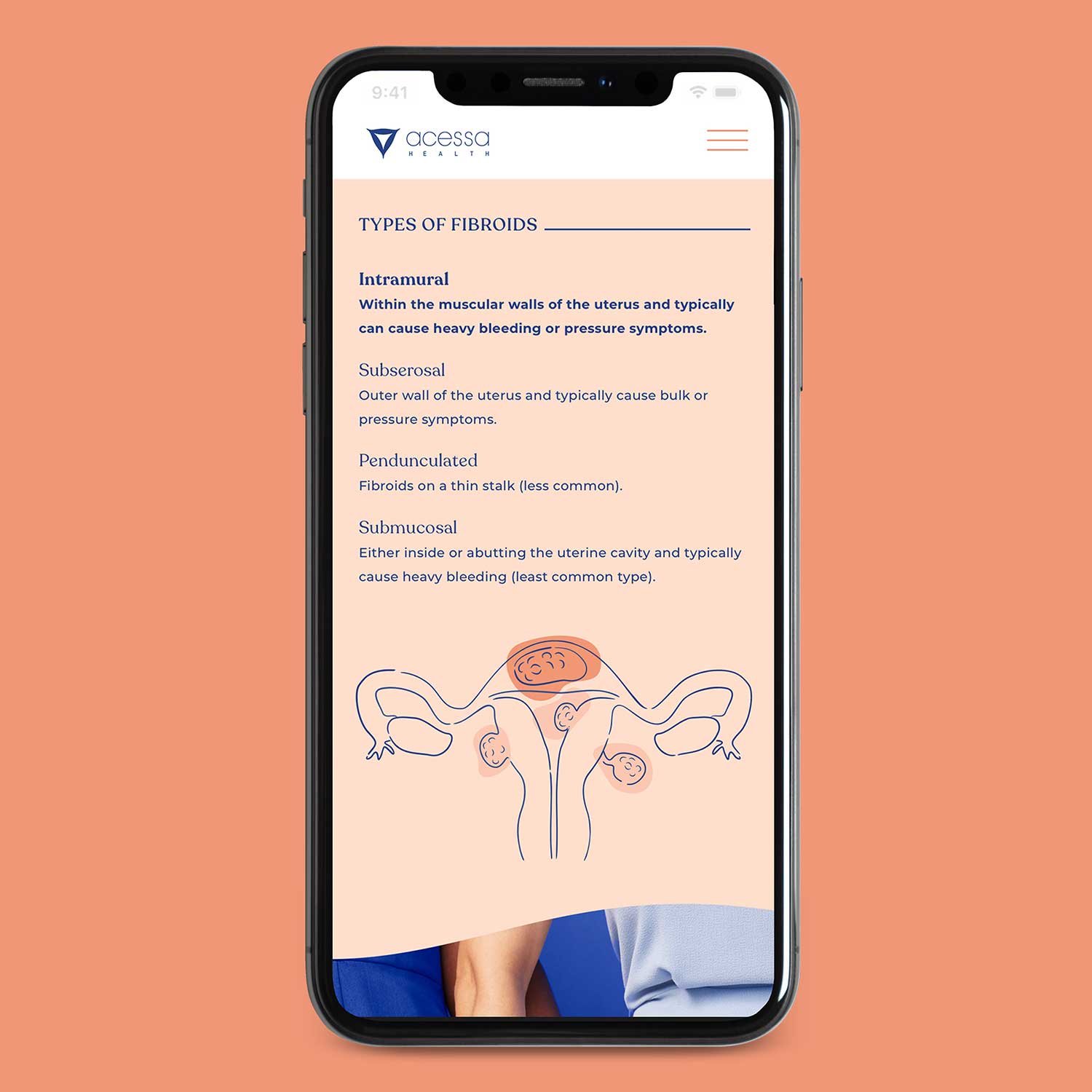 672136598caeb71a7c77cf9a_5ea8b15c20cb1c341765b6aa_Illustration_MocksPhone-1.jpeg