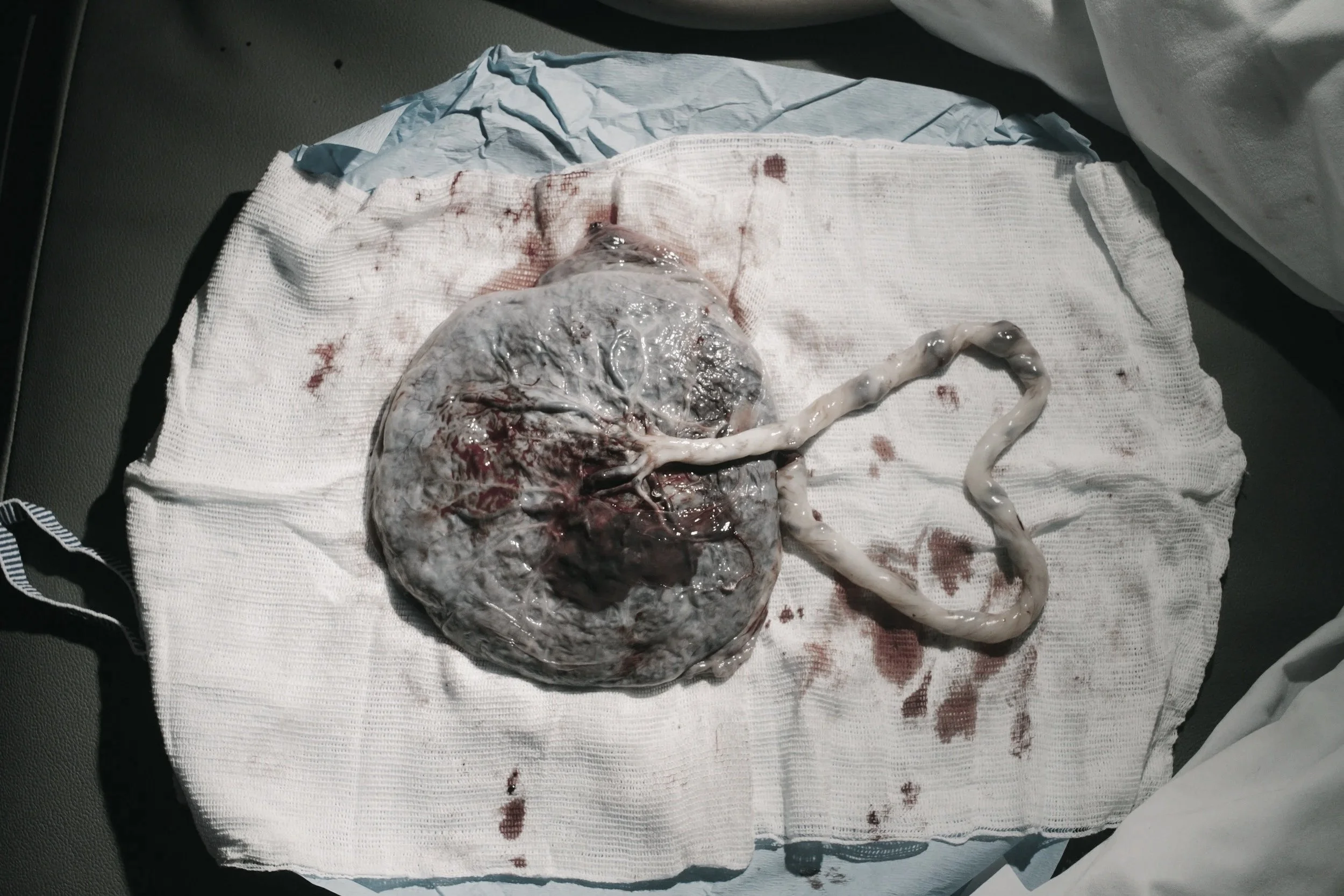 placenta
