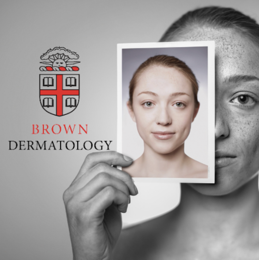 Brown University Health: Dermatology