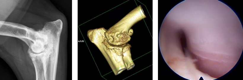 Une radiographie, une image 3D et une image d'arthroscopie d'une articulation du coude.