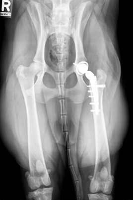 Radiographie de pelvis avec prothèse totale de la hanche.