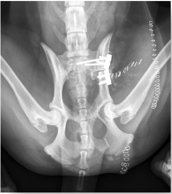 Radiographie du bassin montrant une intervention chirurgicale (triple ostéotomie du bassin).
