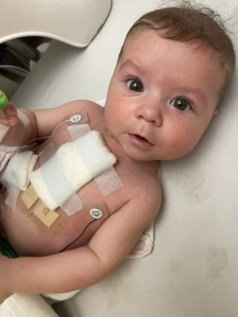 A baby with medical tubing and electrodes attached, lying on a hospital bed.