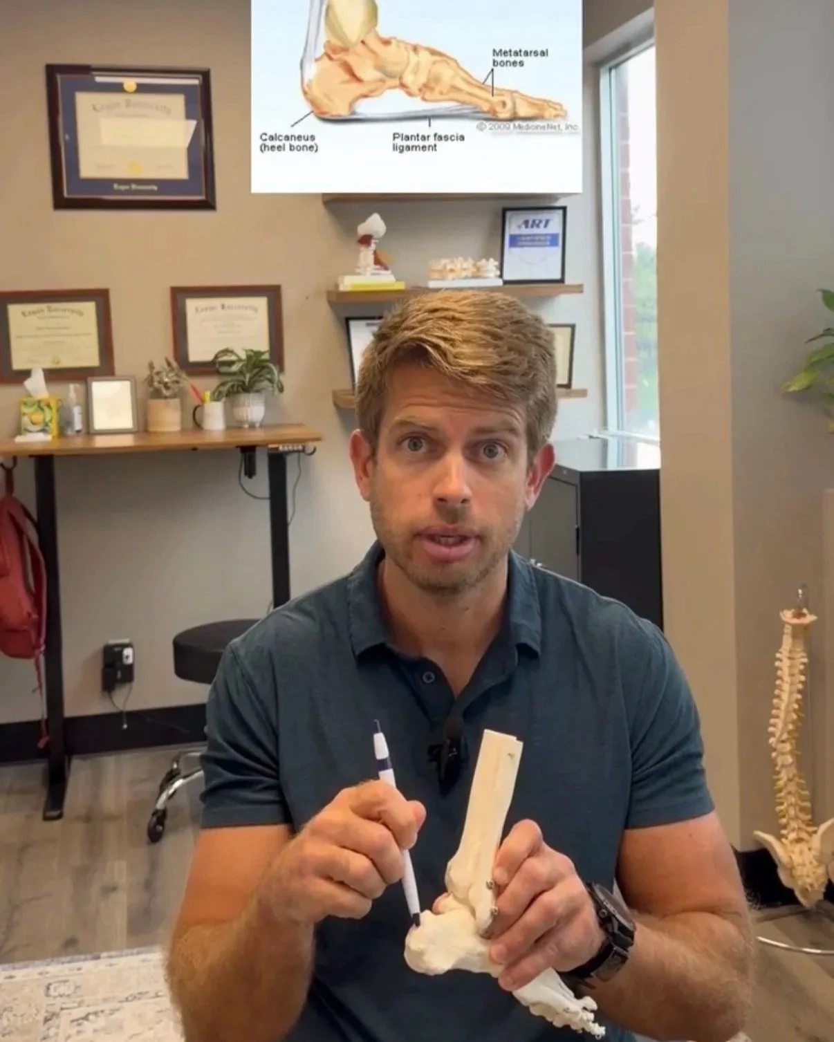 Why Your Achilles and Plantar Fasciitis Keep Coming Back (They're the Same Problem)