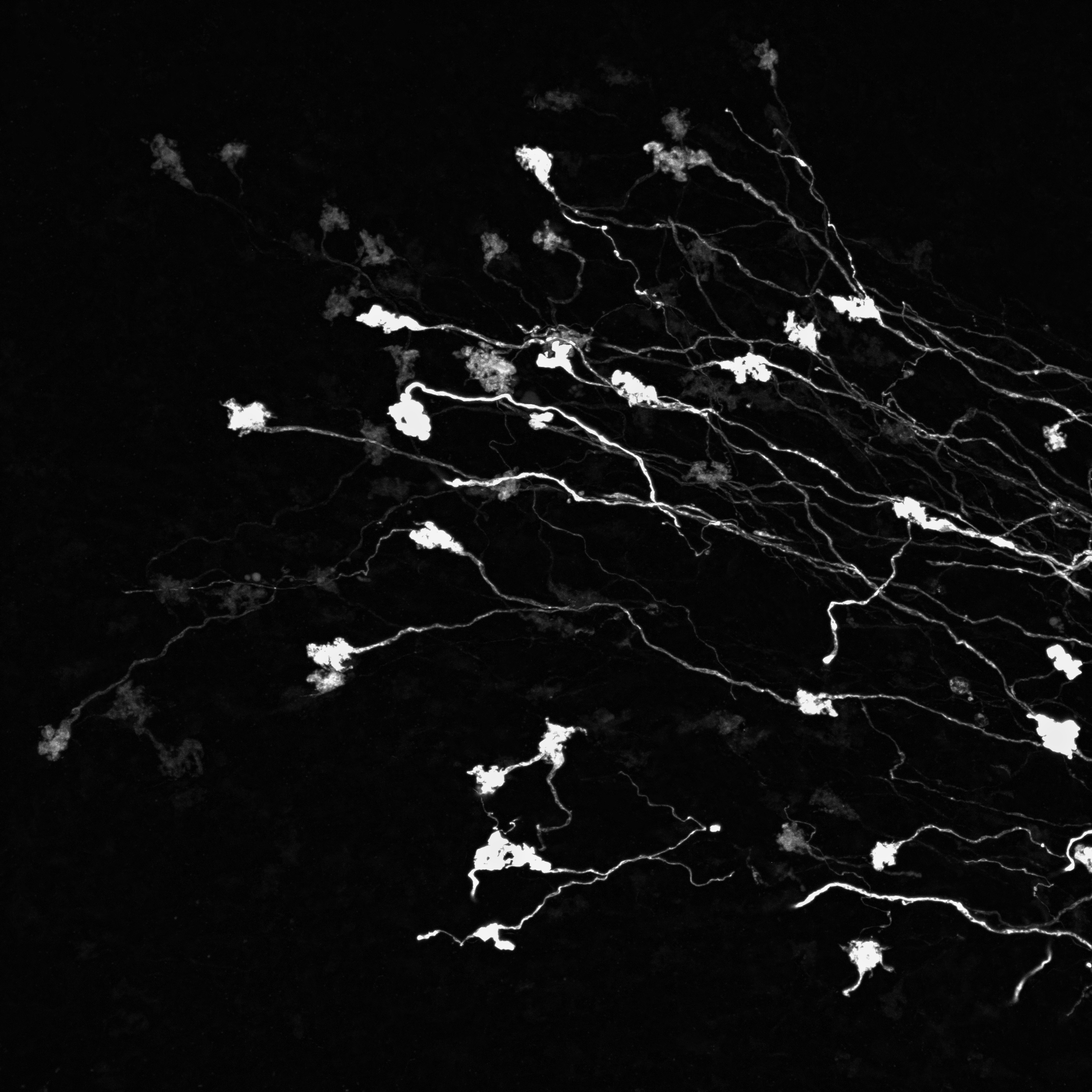 Fluorescence microscopy image of mossy fiber axons in the mouse cerebellar cortex, showing bright rosette terminals connected by thin, axonal processes against a dark background.
