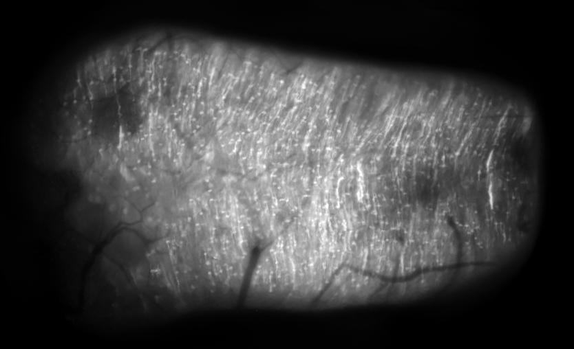 An optically sectioned one-photon image of lobule Crus I of the cerebellum, with molecular layer interneurons labeled with the voltage indicator, pAce.