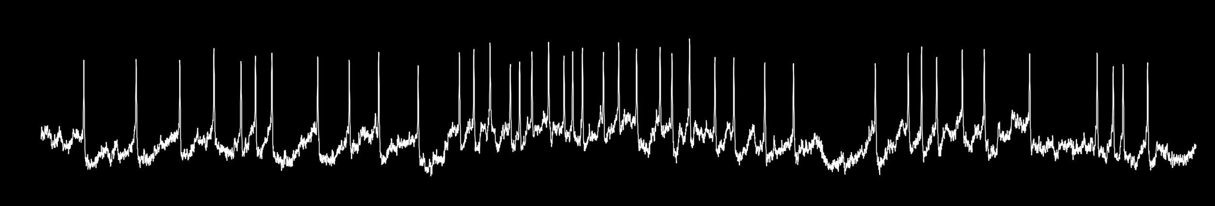 Voltage imaging recording of a molecular layer interneuron expressing pAce.