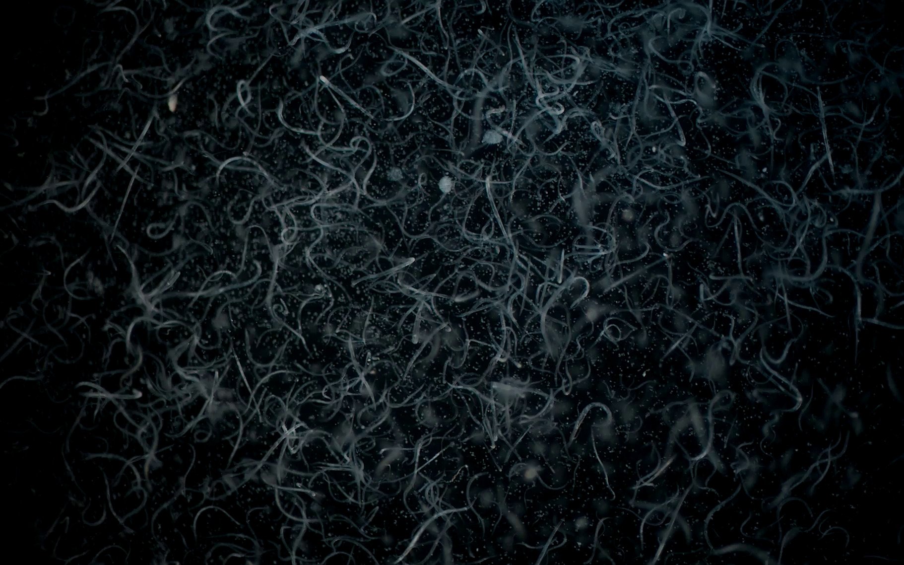 Micro Worm Culture
