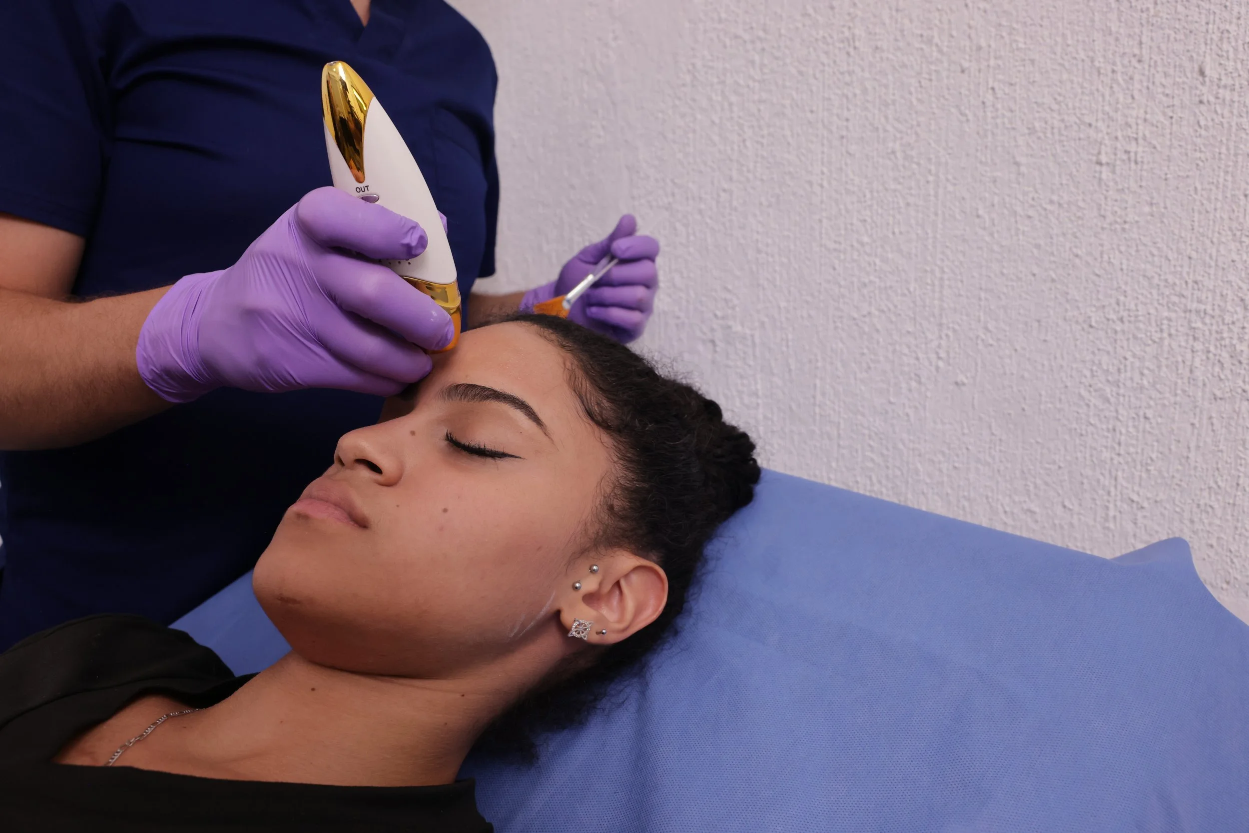 A person lying on a medical table with eyes closed, receiving a cosmetic or medical treatment on the forehead from a professional wearing purple gloves, holding a device and a small tool. The person has earrings and a necklace, and the background shows a plain wall.