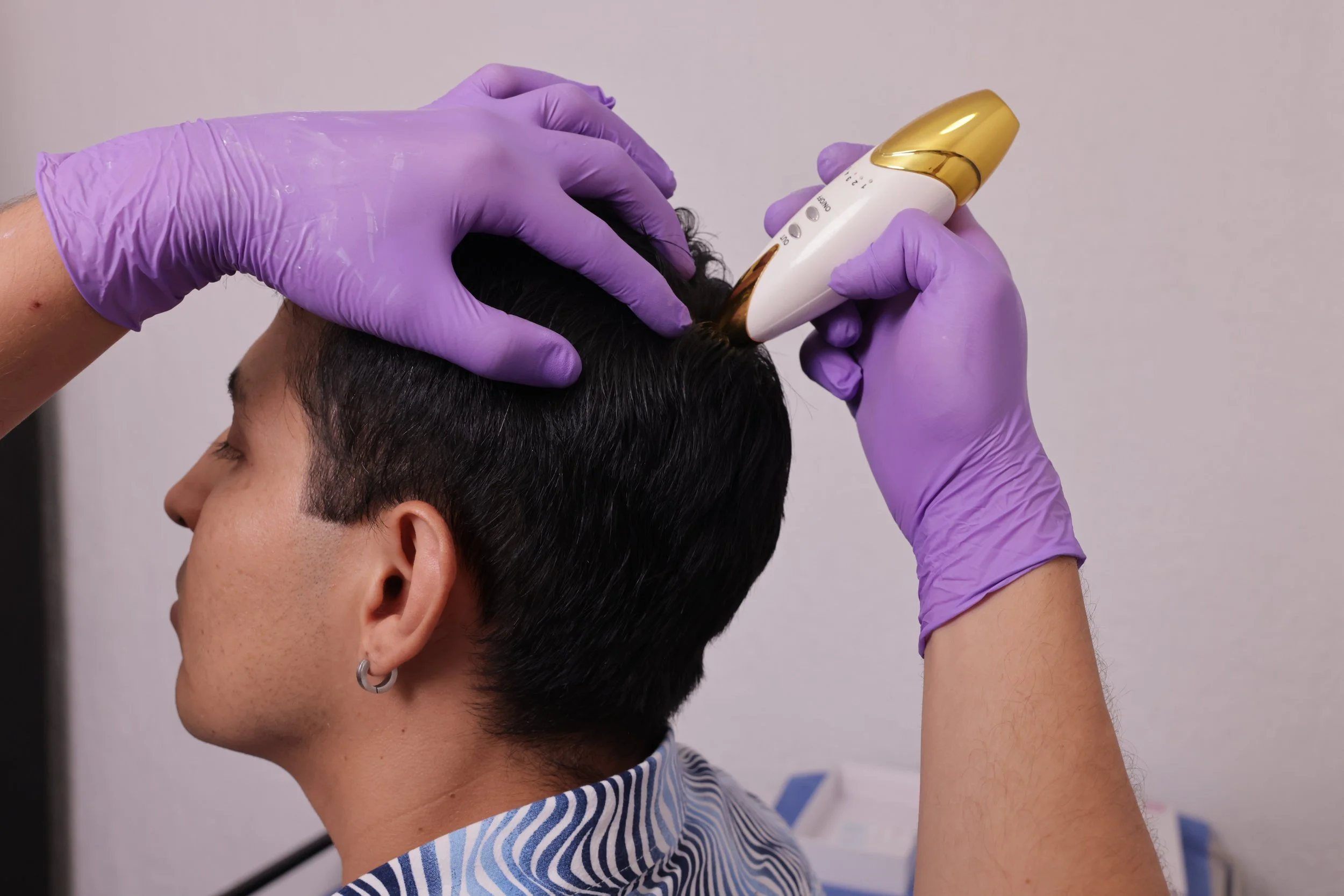 Person with short dark hair getting a scalp treatment applied with a white and gold device, wearing purple gloves.