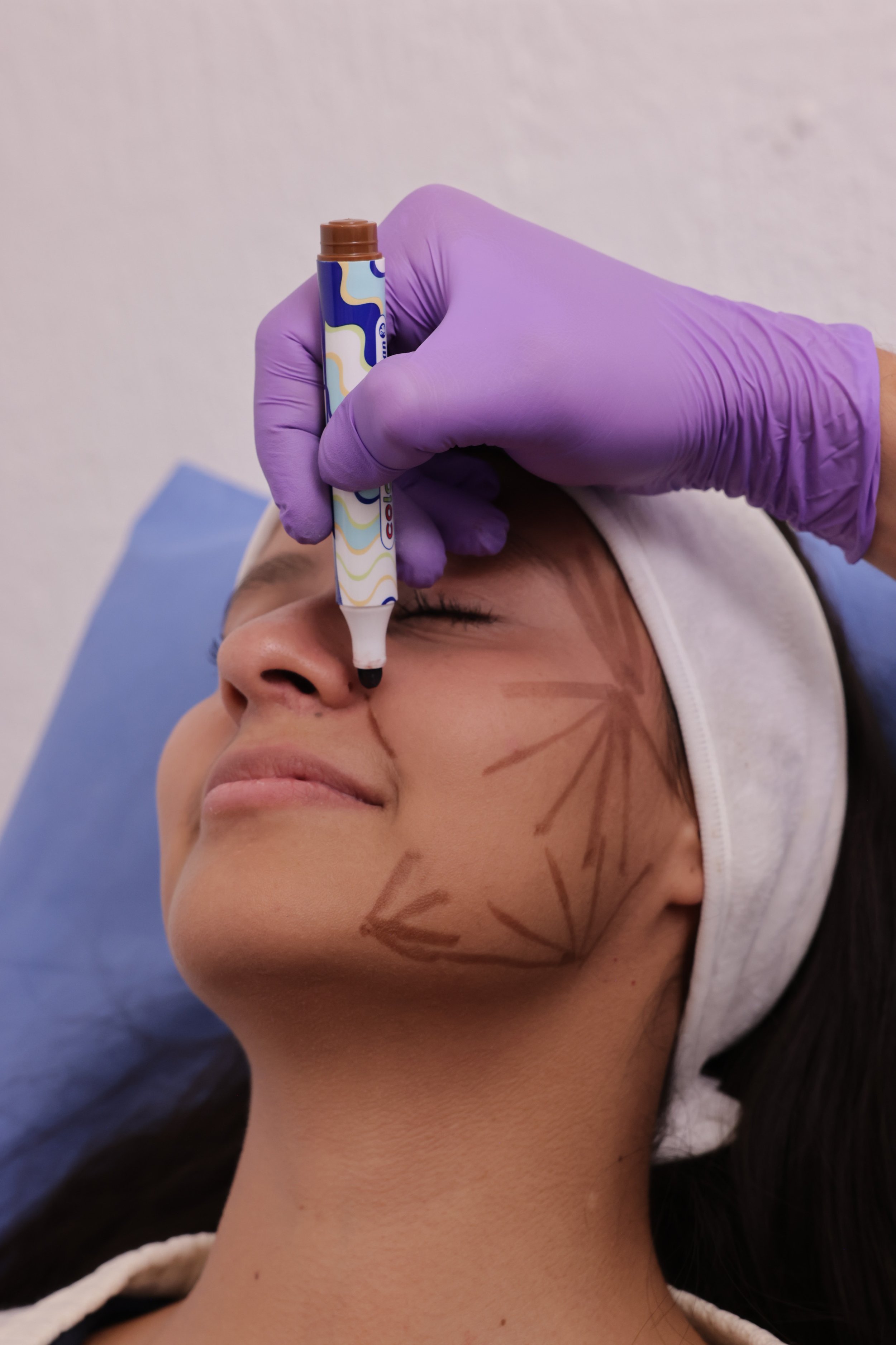 A person lying down with their eyes closed, having markings on their face and neck, while a gloved hand holds a medical marker near their forehead.