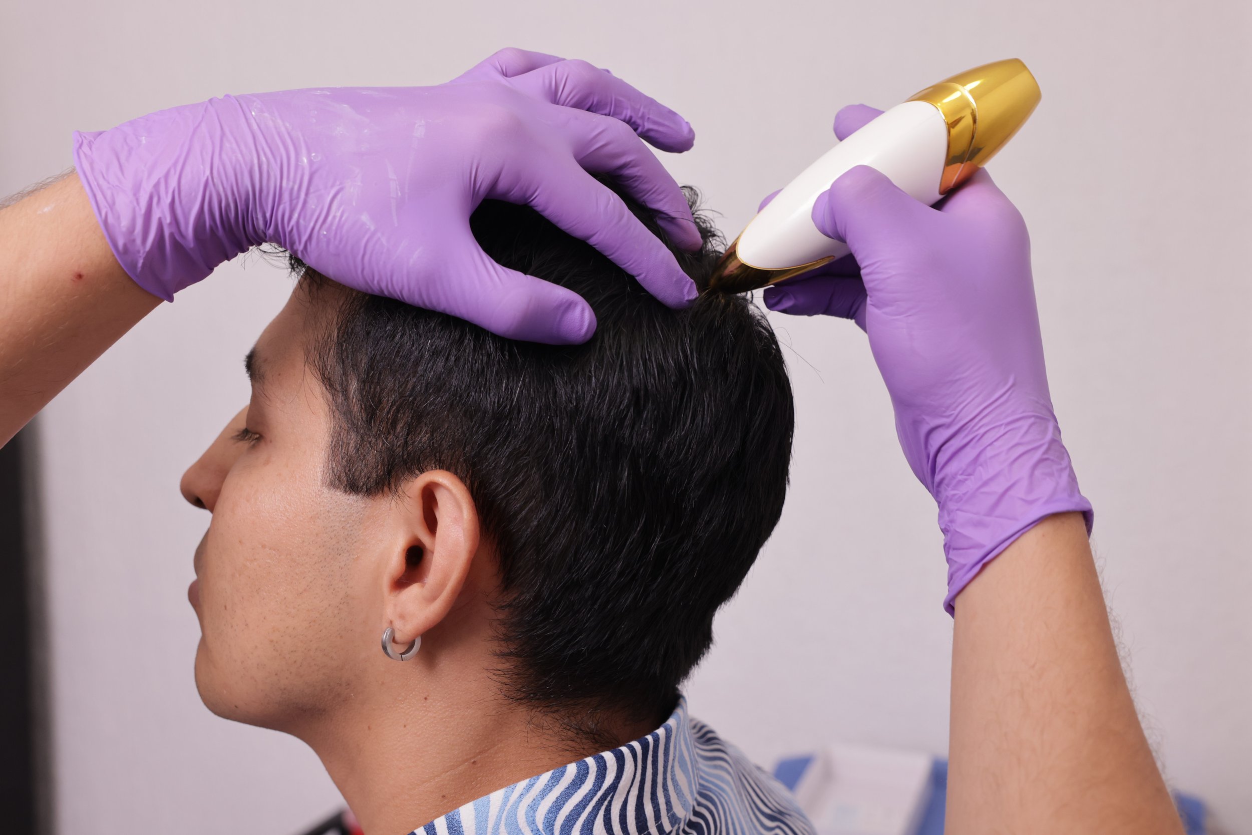 A person getting a scalp treatment or haircut, wearing a striped shirt, while another person with purple gloves holds a hair device on their head.