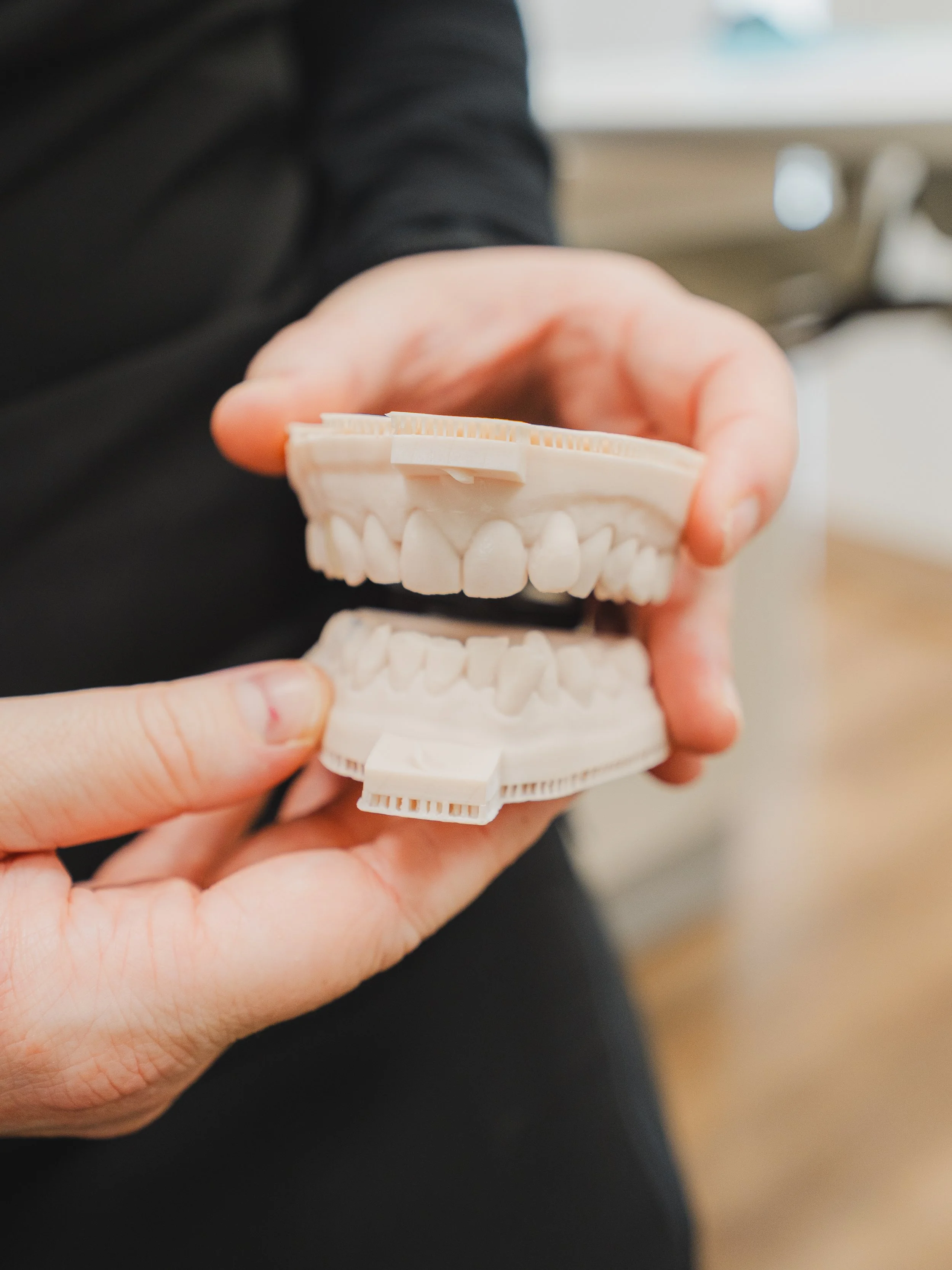 A person holding a dental model showing upper and lower teeth.