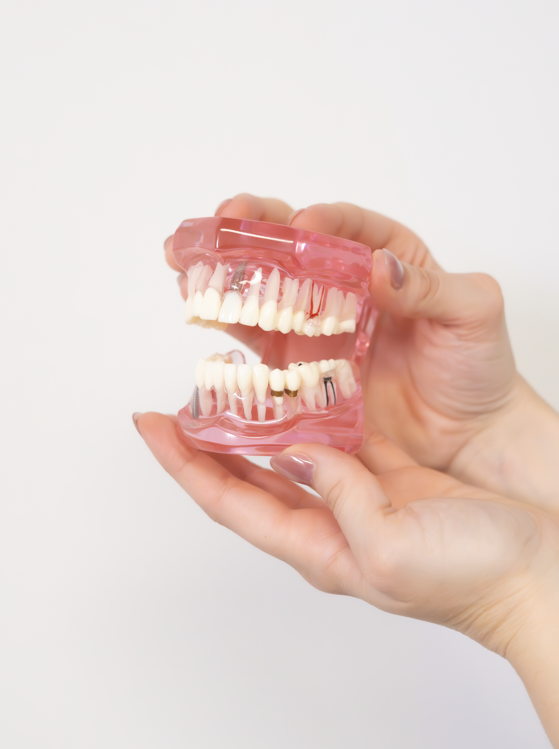 Hand holding a pink dental model with artificial teeth.