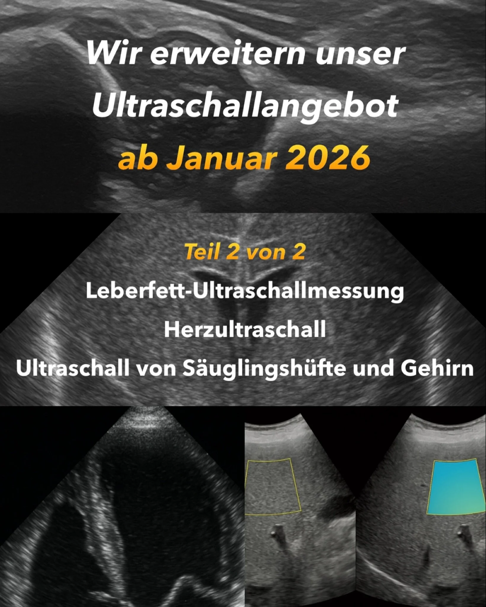 🩺 Teil 2 von 2
Wir erweitern unser Ultraschallangebot f&uuml;r unsere Patienten!

⸻

✨ Ab Januar 2026 bieten wir weitere Vorsorge und Screening Ultraschalle an.
Damit k&ouml;nnen wir Ver&auml;nderungen und Erkrankungen noch fr&uuml;her erkennen. 
Di