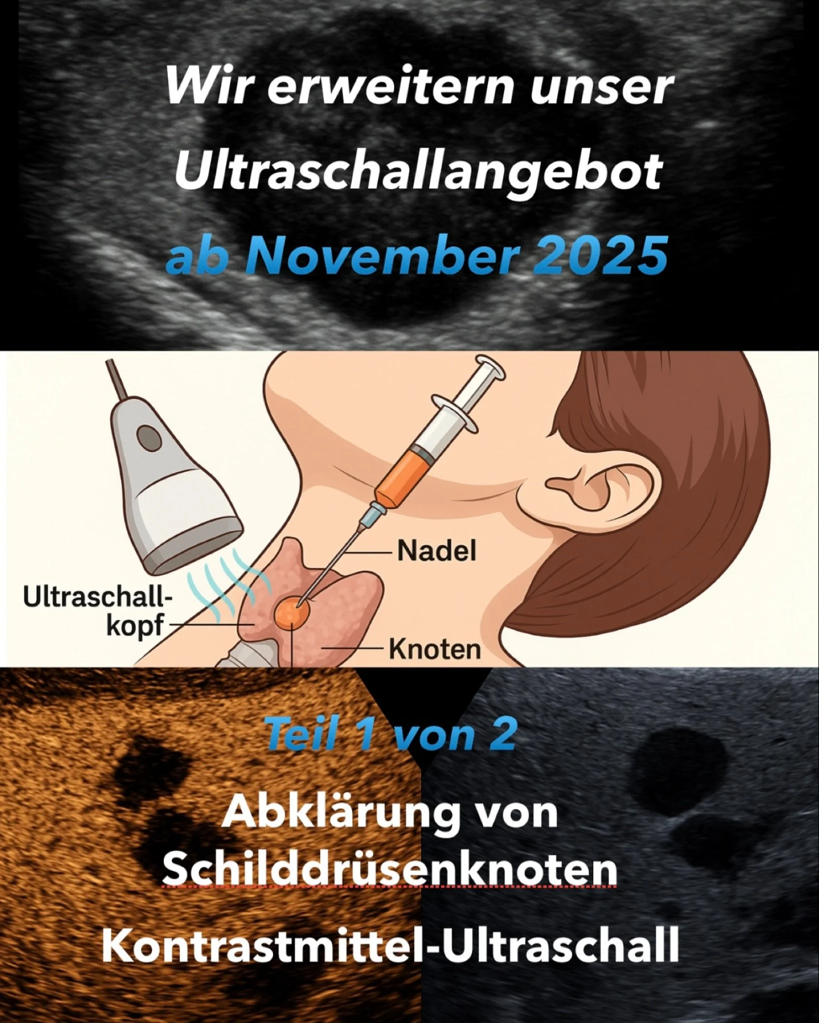 🩺 Teil 1 von 2
Wir erweitern unser Ultraschallangebot f&uuml;r unsere Patienten!

⸻

Ab November und Dezember 2025 bieten wir zwei spezialisierte Ultraschallverfahren direkt in unserer Praxis an. 
F&uuml;r eine moderne, strahlenfreie und wohnortnahe