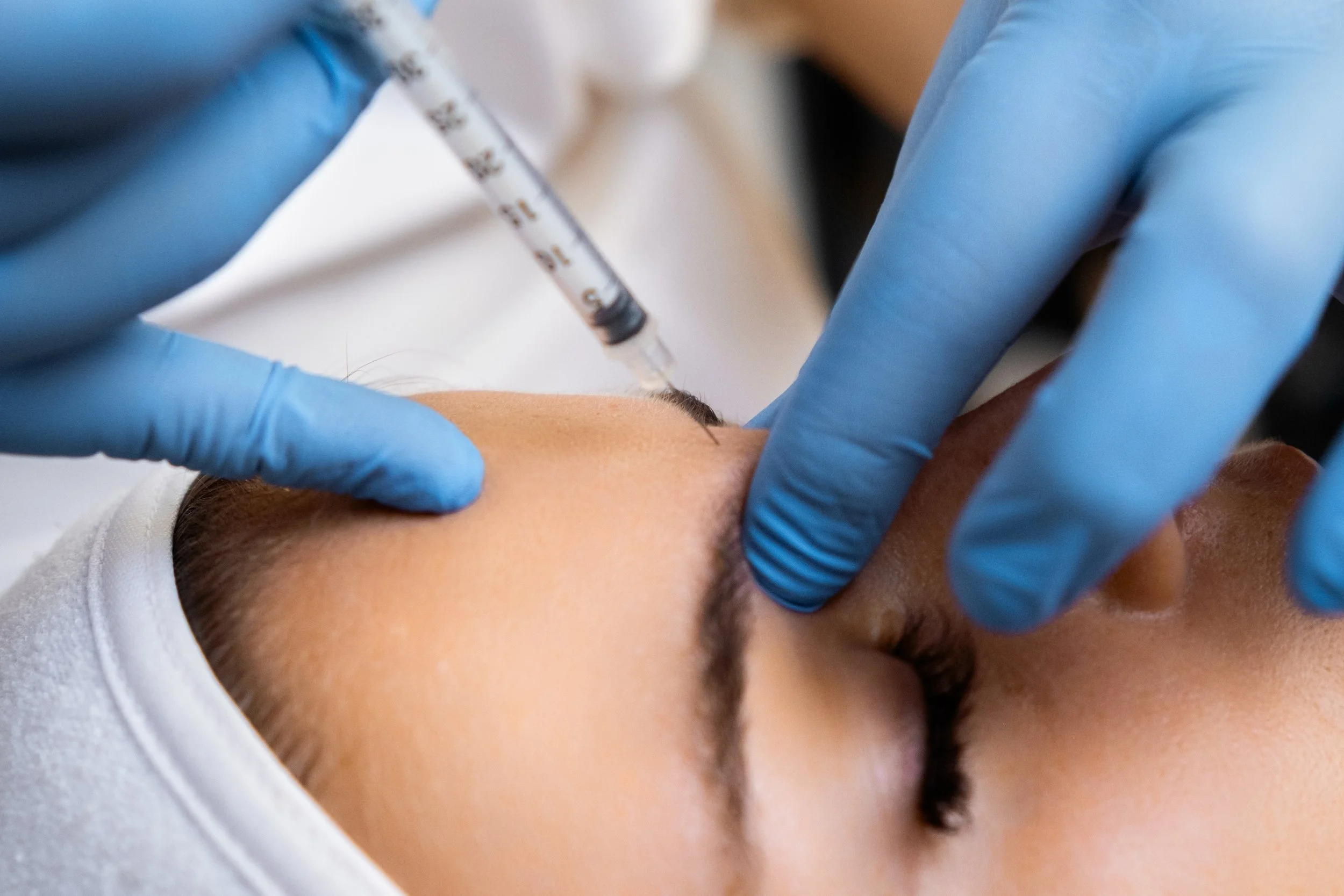 Botulinum Toxin