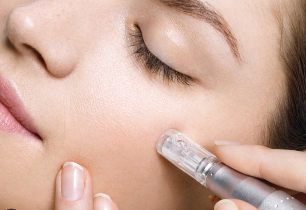 Microneedling