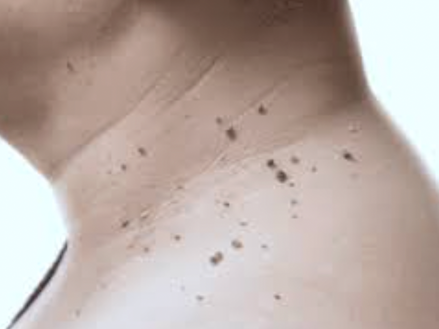 Clinical and Surgical dermatology procedures