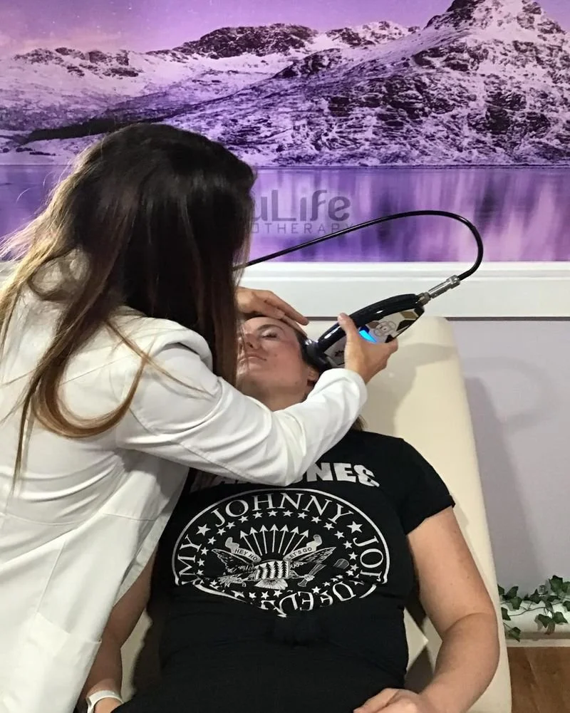FROTOX FACIAL