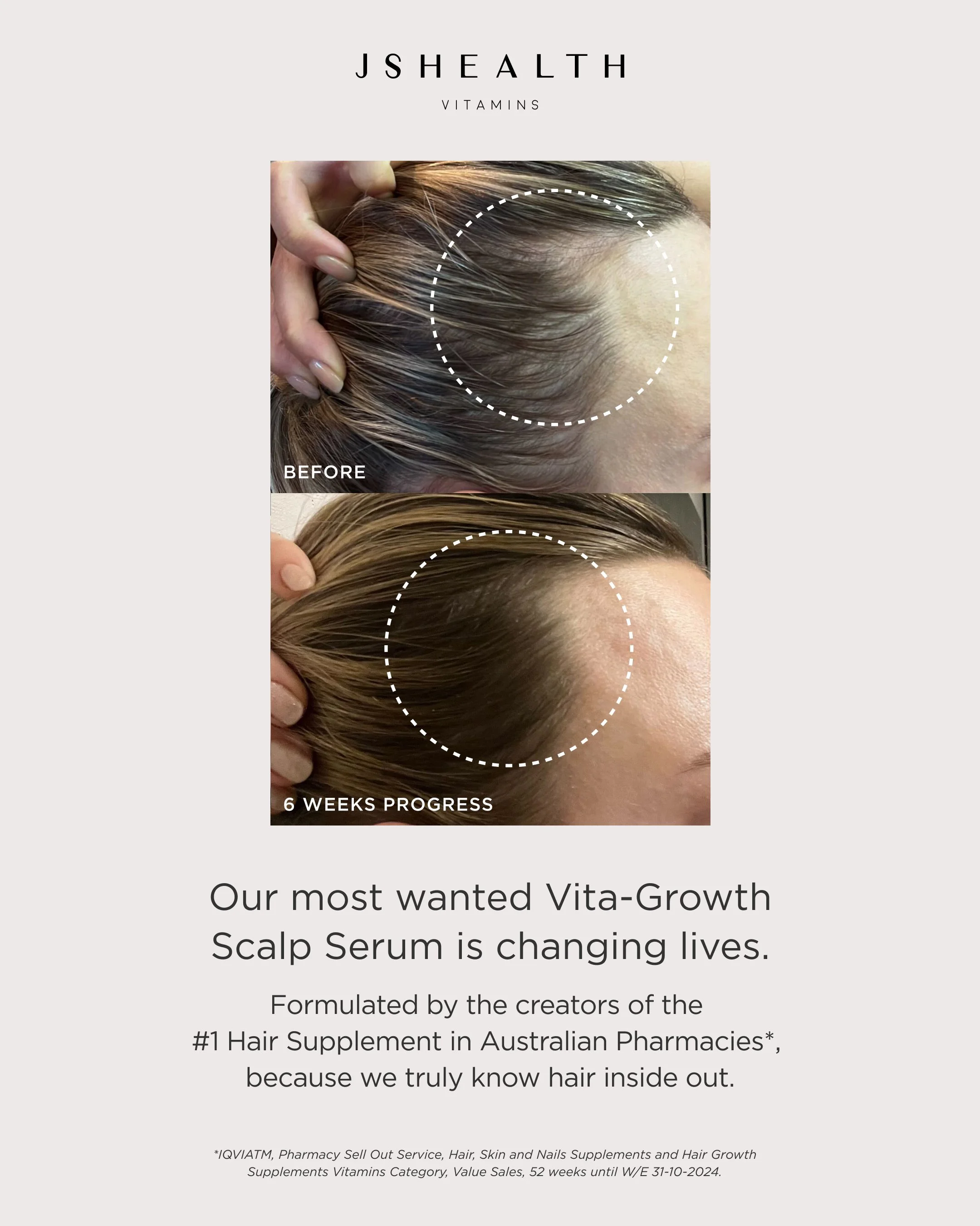 Ad-8-Week-3-Post-Scalp-Serum.jpg