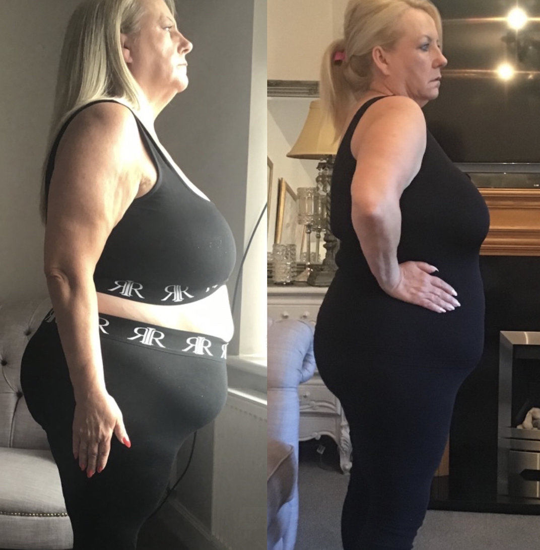 Side-by-side comparison of a woman before and after weight loss, wearing black sportswear, showing her profile from the waist up.
