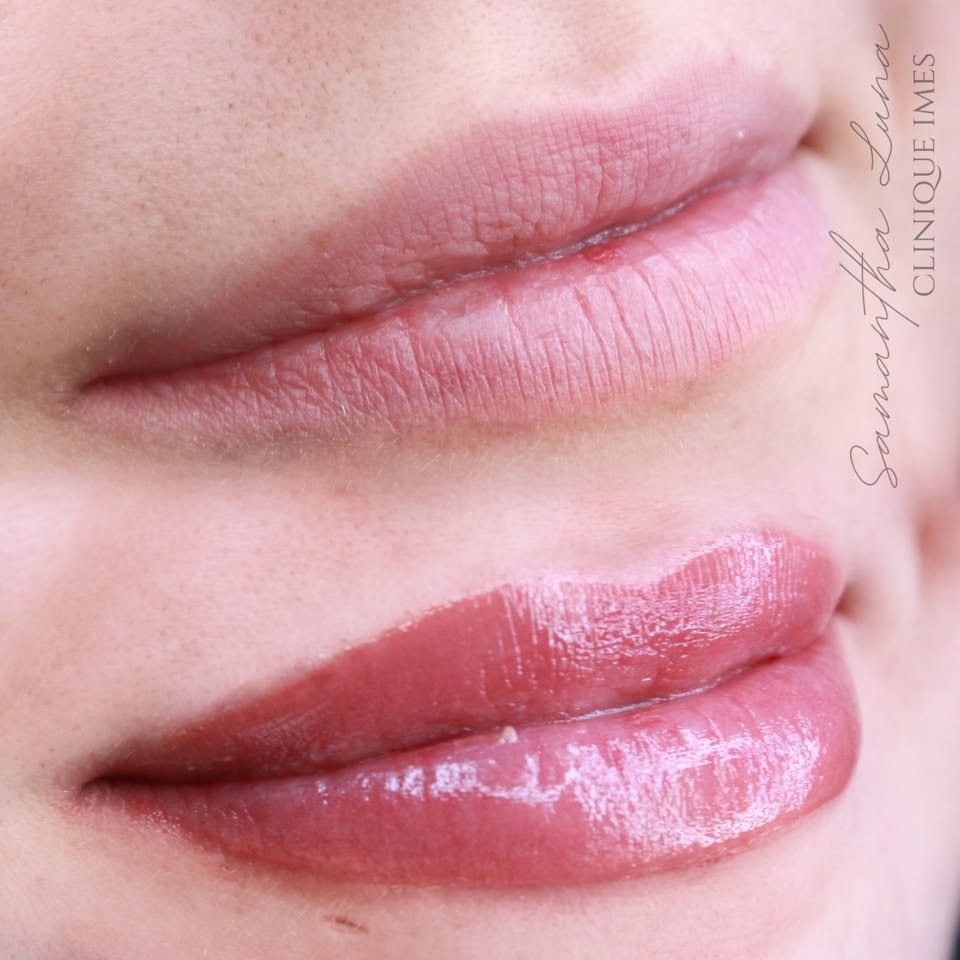 Close-up of a person's lips, with the top lip being natural and the bottom lip with shiny pink lipstick. The person's skin is light and slightly freckled.
