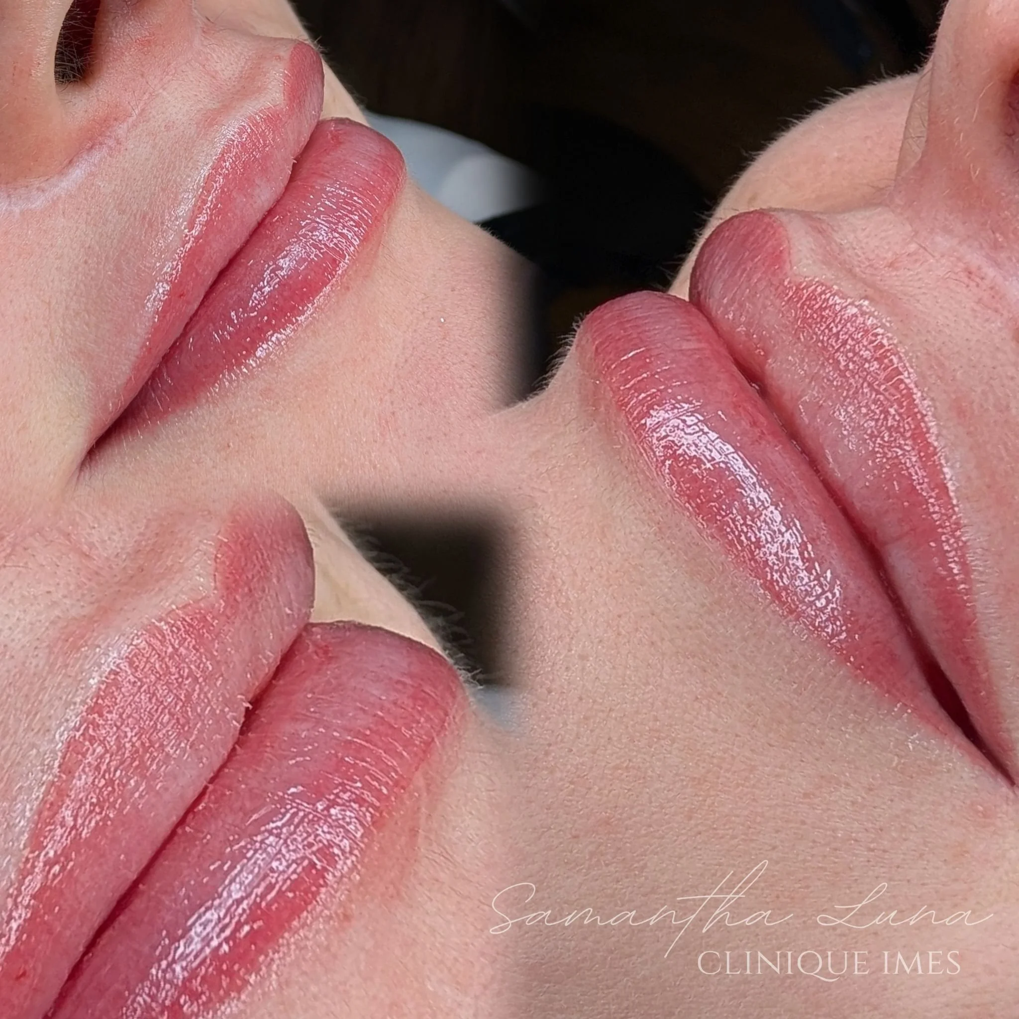 Close-up photo of two women touching their lips with their fingers, showing detailed textures of skin and lips, with a blurred dark background.