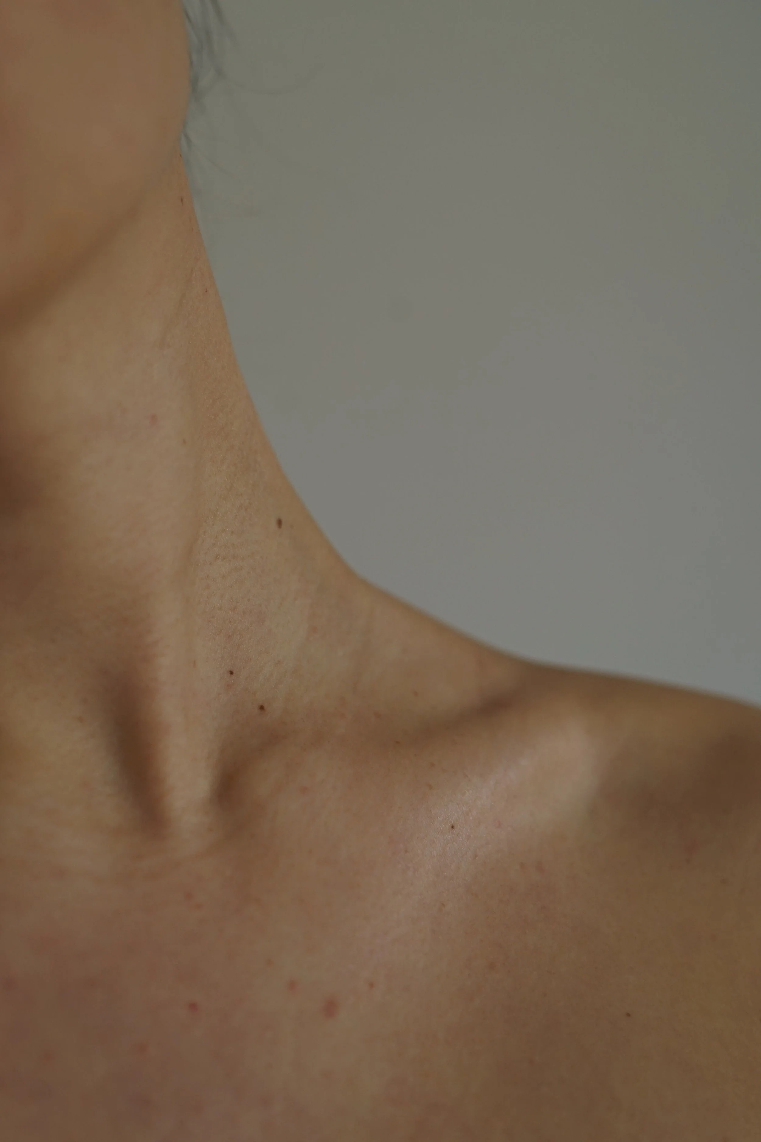 Close-up of bare skin, possibly part of a person's face or neck, with freckles and small moles.