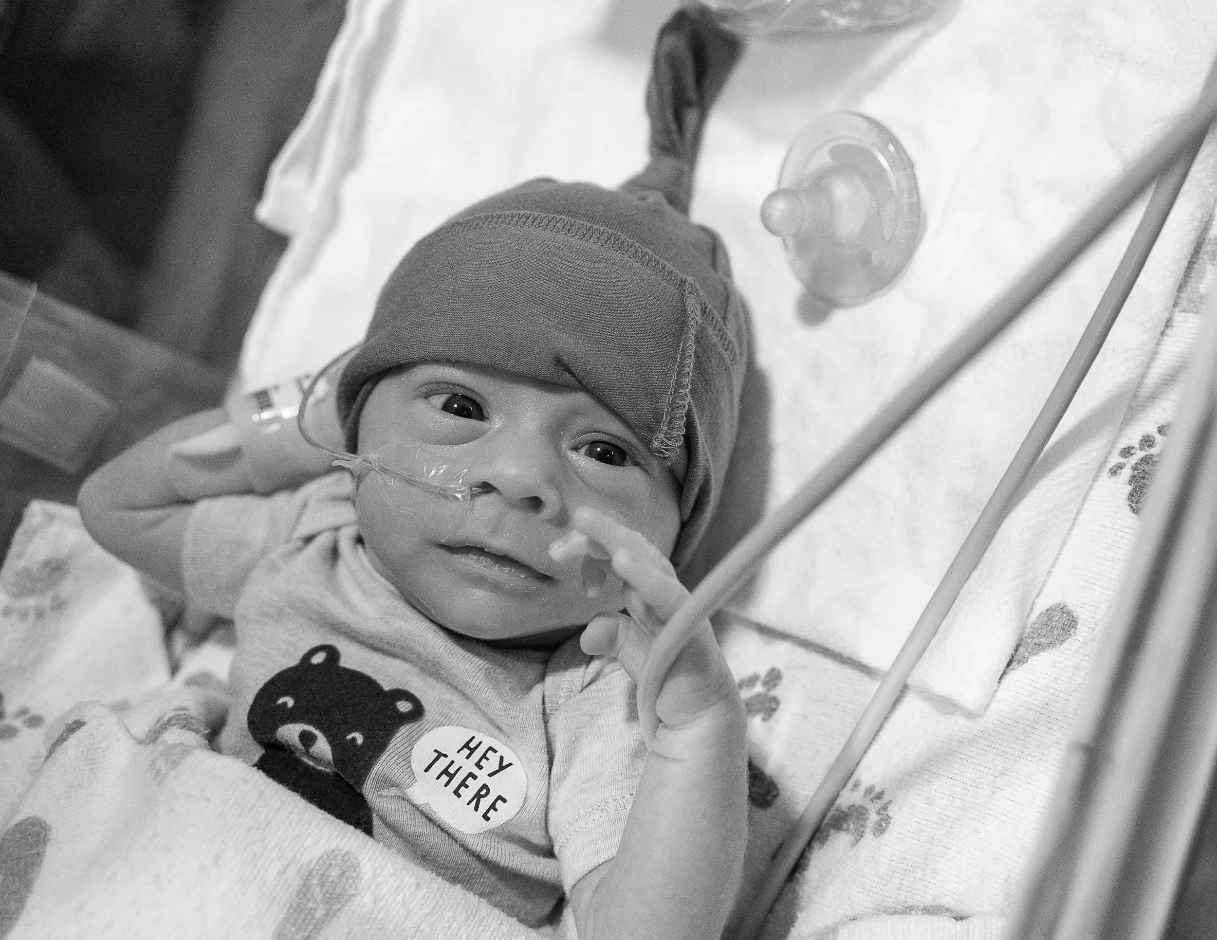 A baby lying in a hospital bassinet with a feeding tube on their face, wearing a beanie cap and a onesie.
