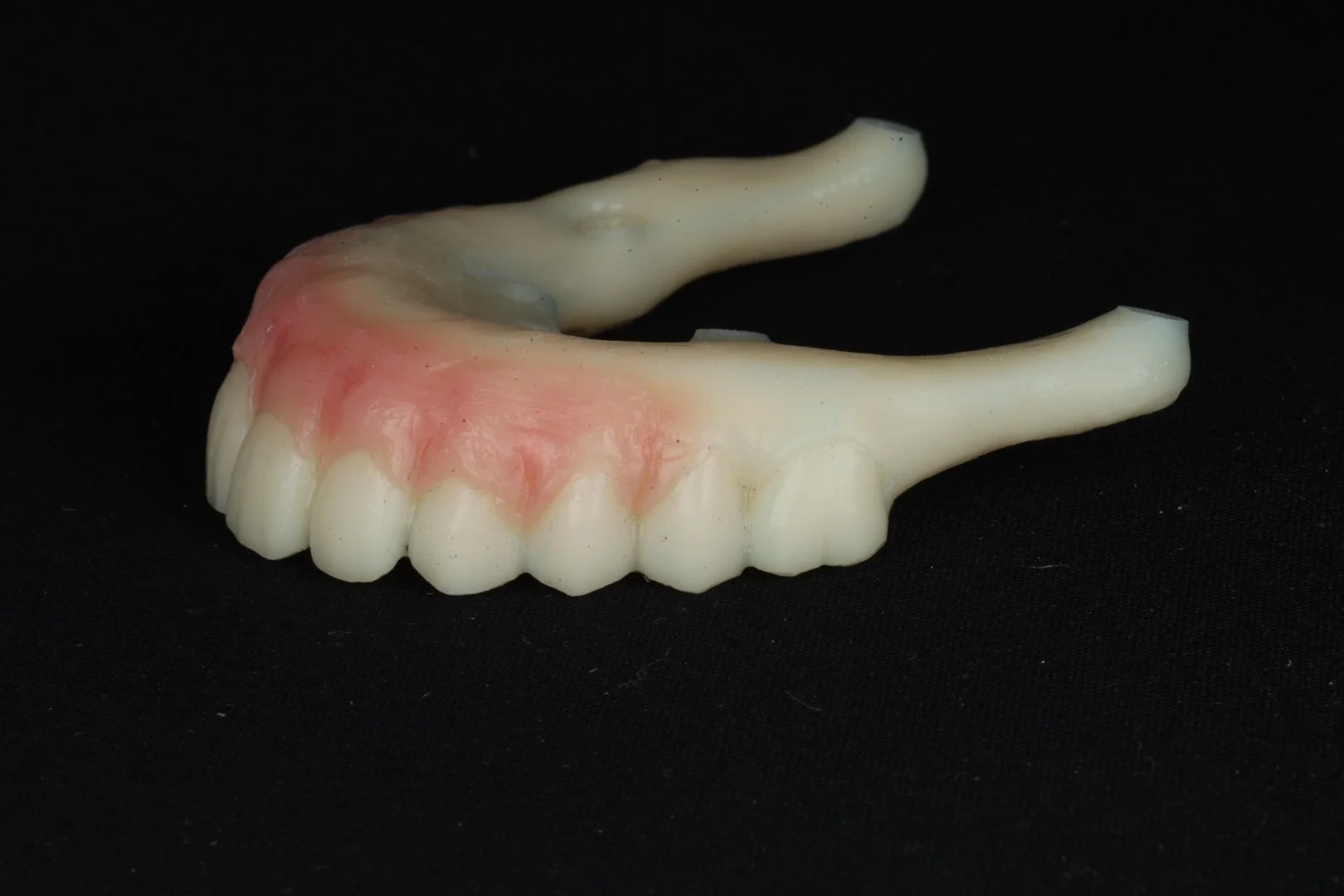 3D Printed Restorations and Appliances