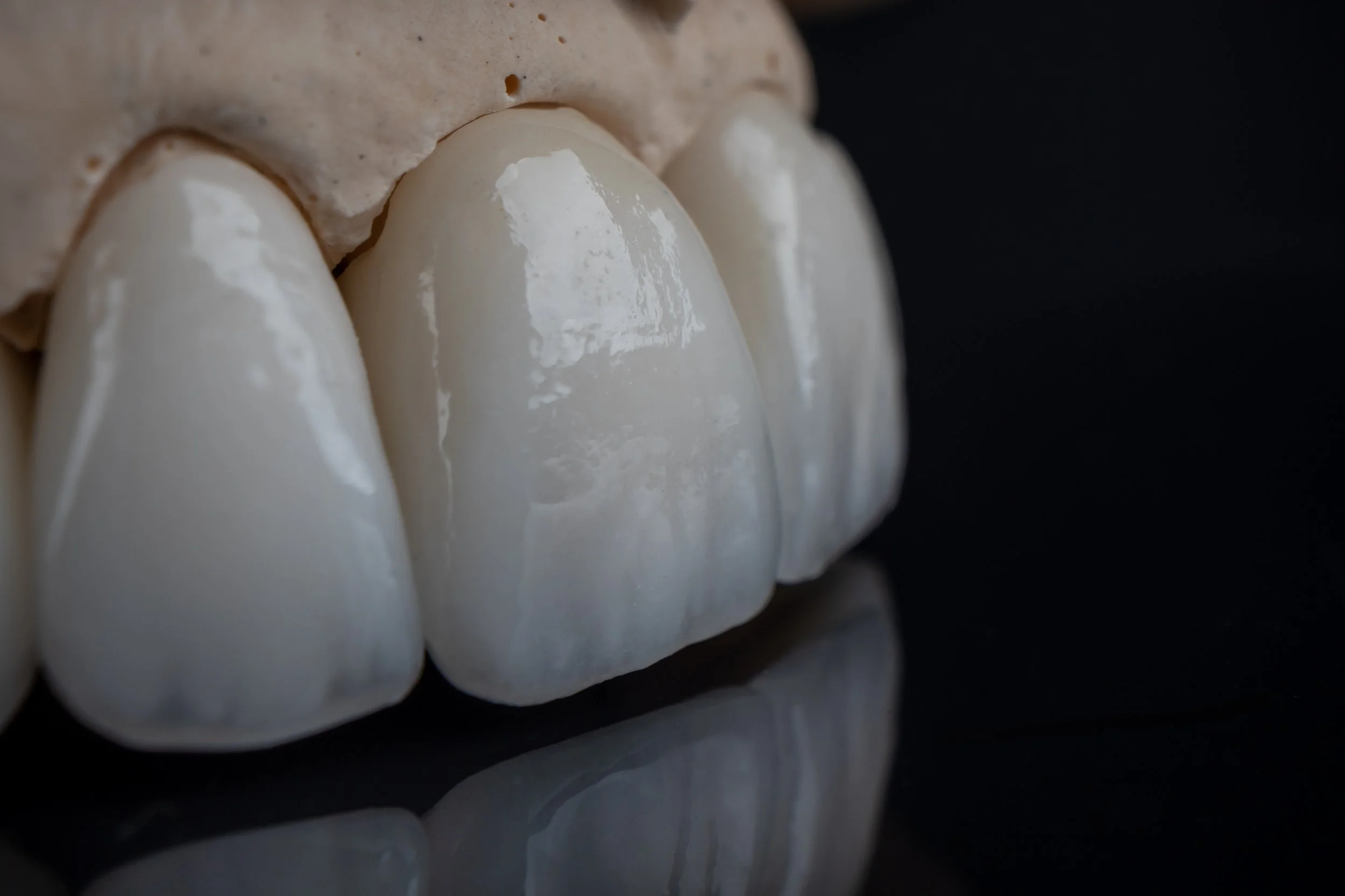 Zirconia Crowns and Bridges