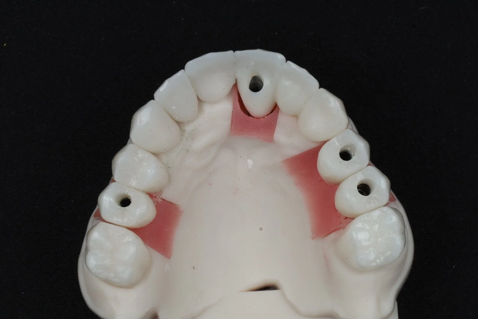 Full Mouth Reconstruction